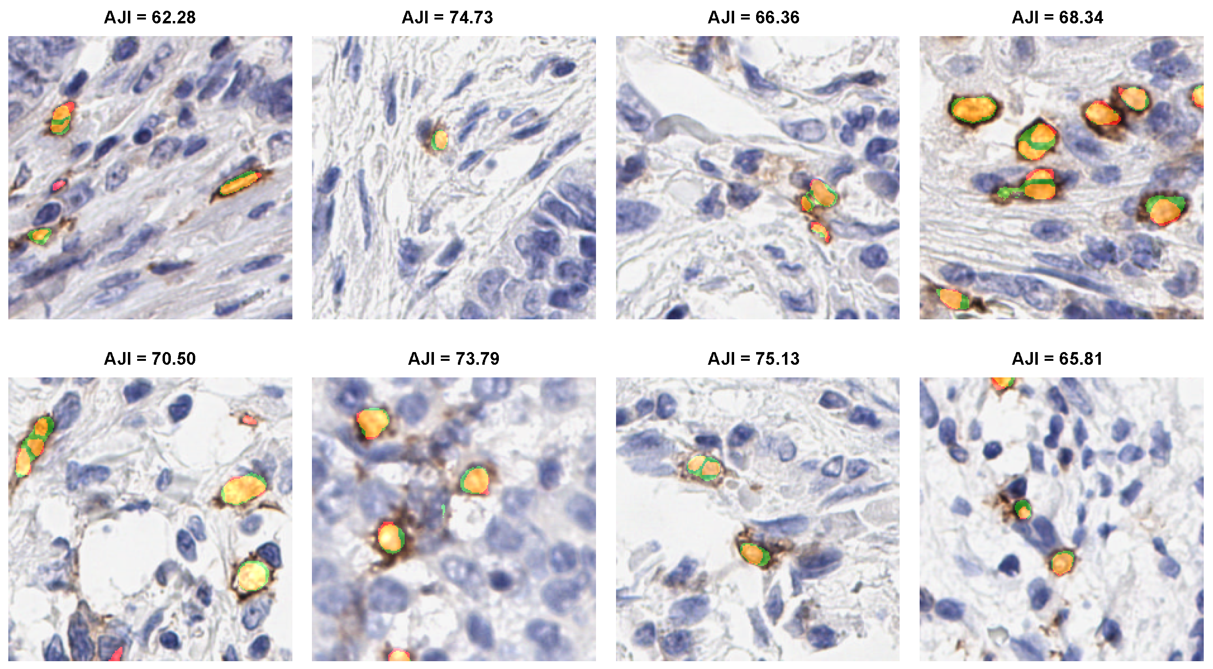 Cancers 14 03910 g004