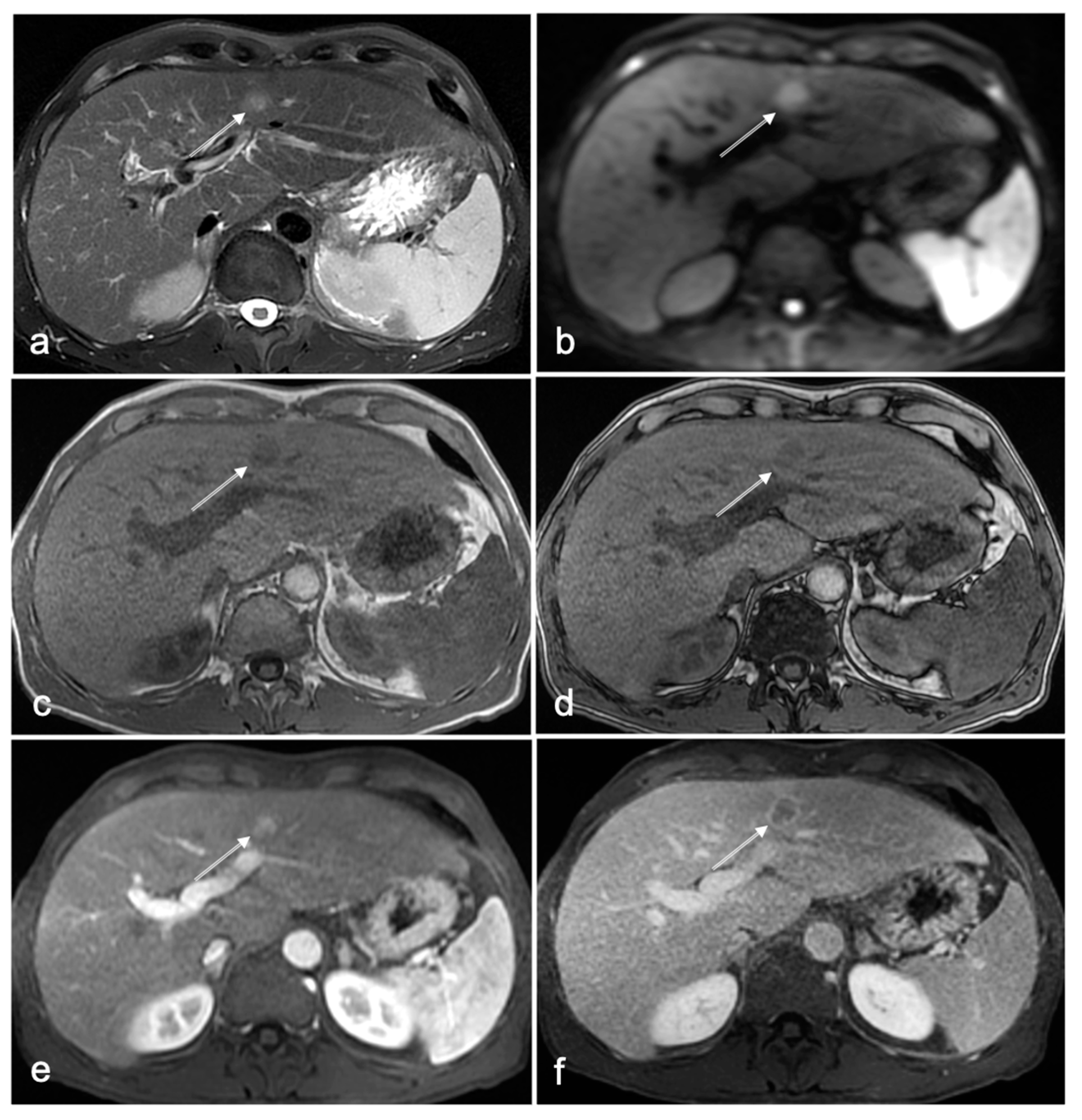 Cancers 14 03961 g002 Cancers 14 03961 g002