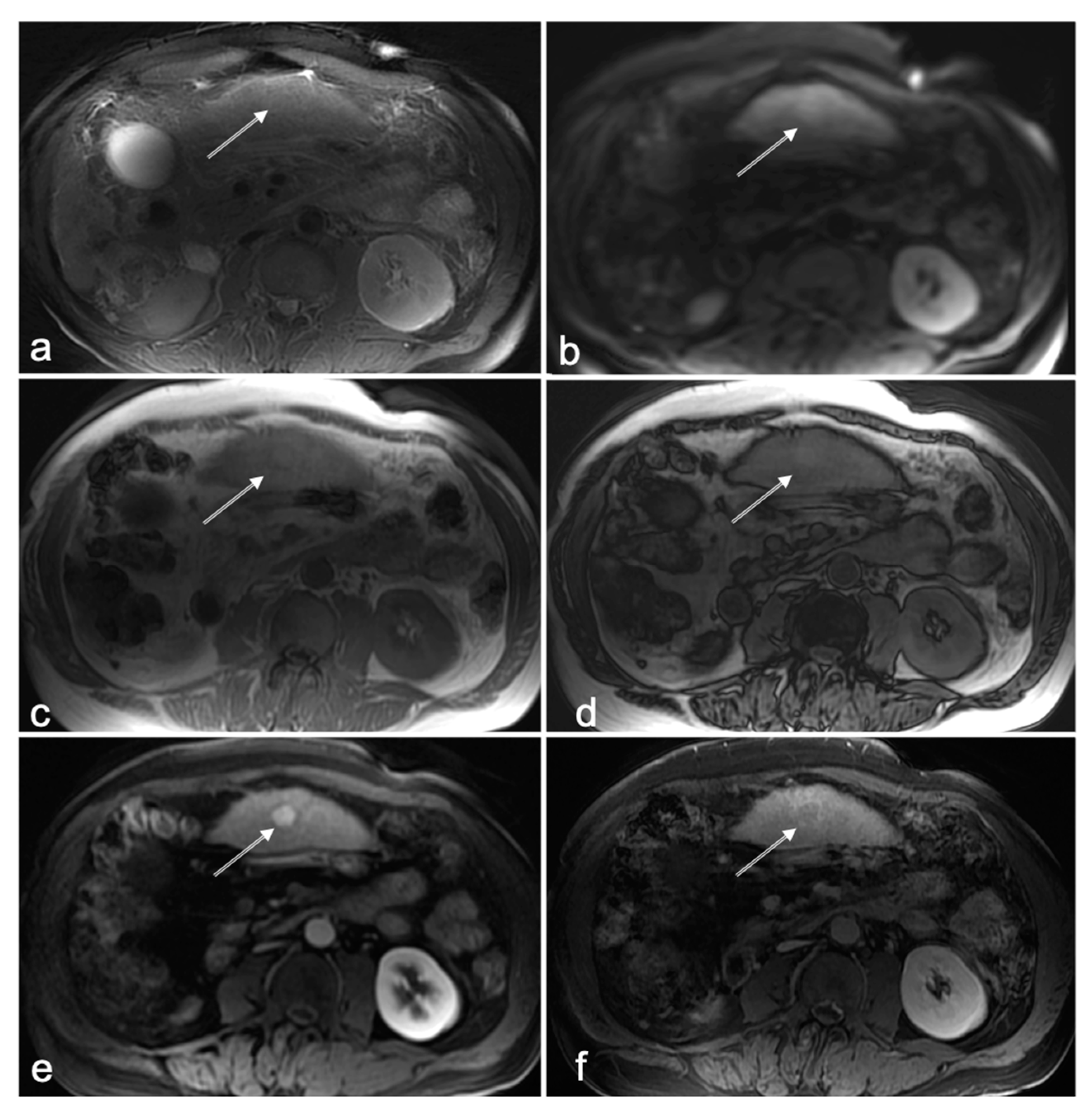 Cancers 14 03961 g003 Cancers 14 03961 g003