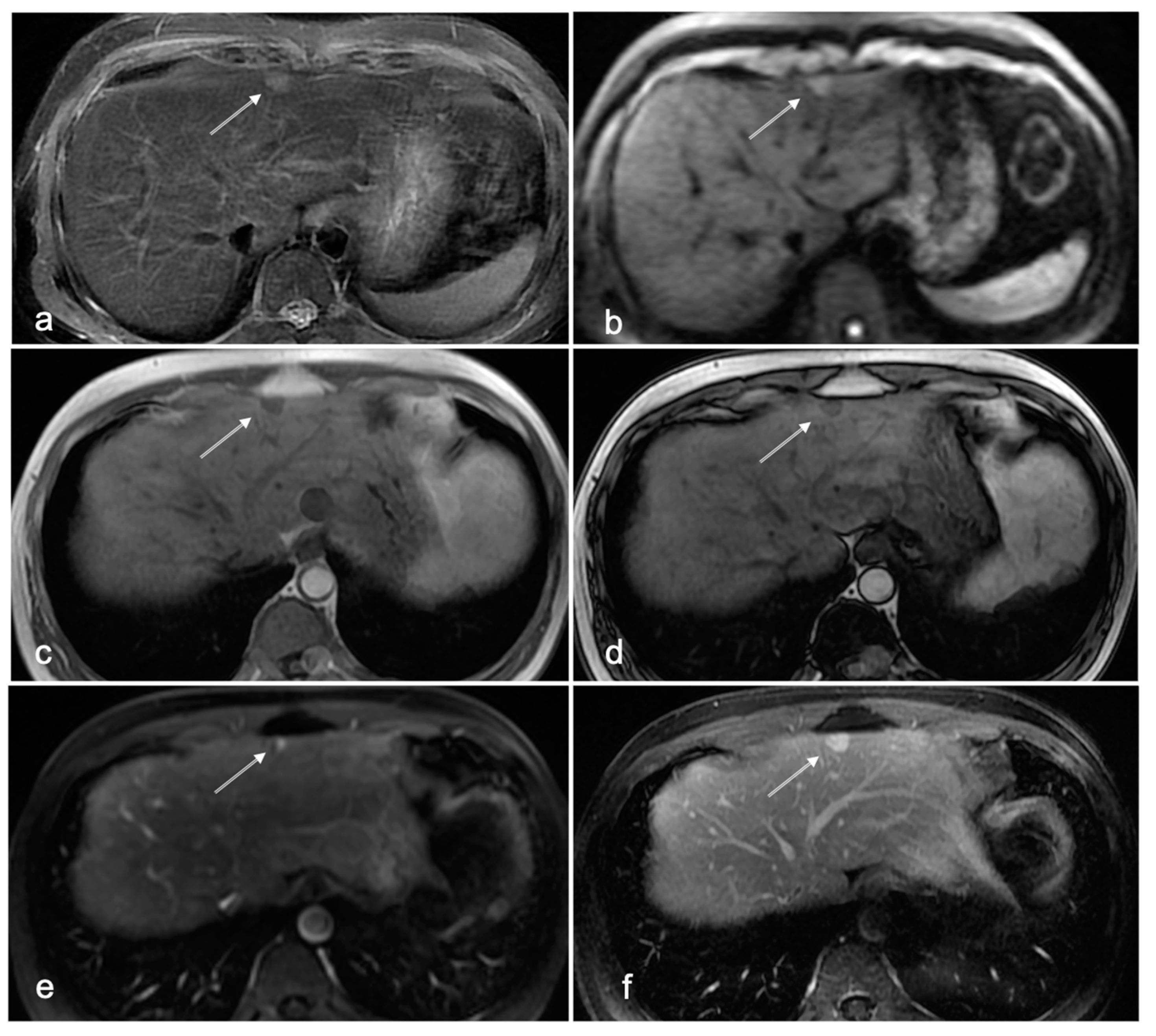 Cancers 14 03961 g004 Cancers 14 03961 g004