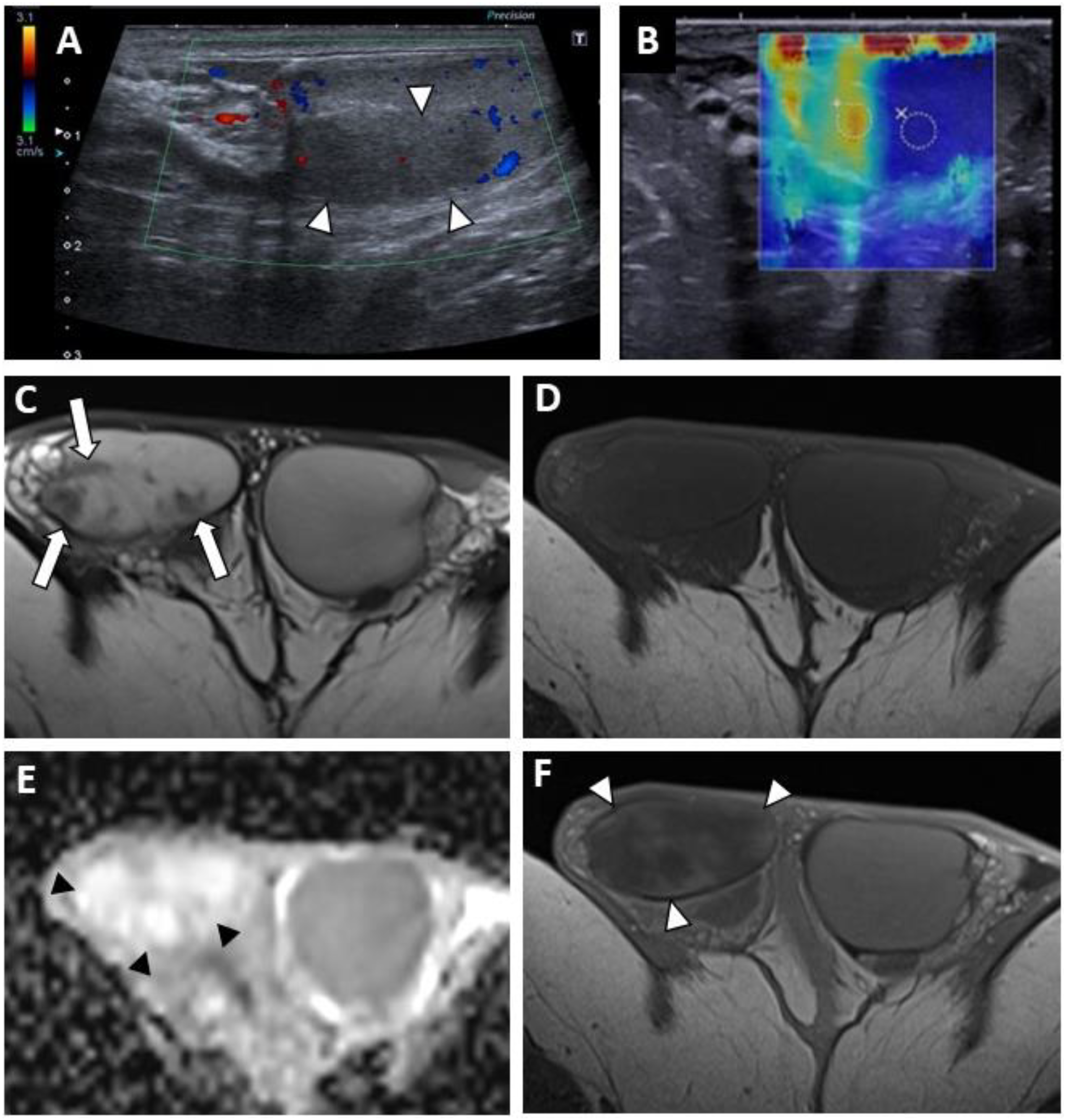 Cancers 14 04013 g002