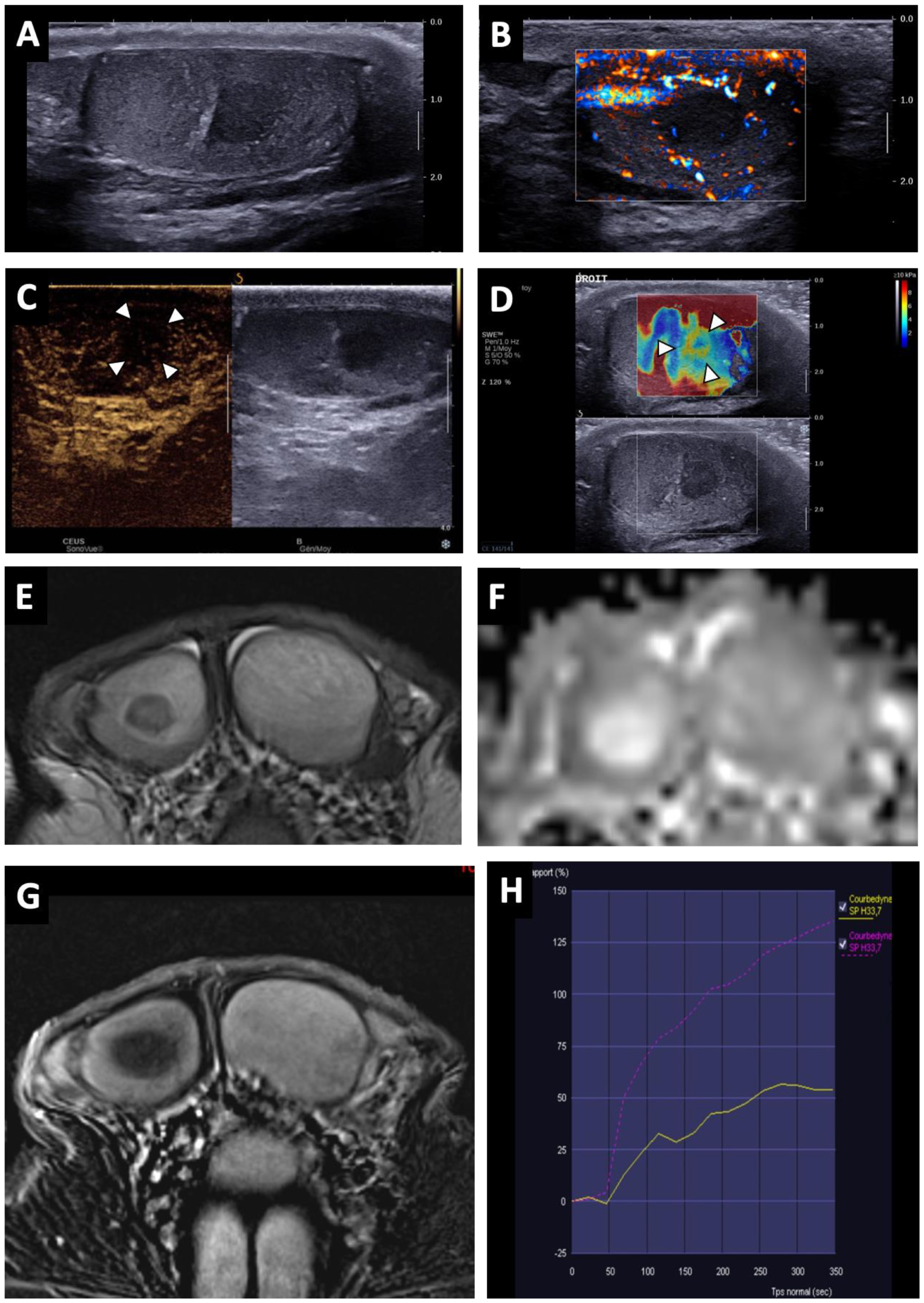 Cancers 14 04013 g003
