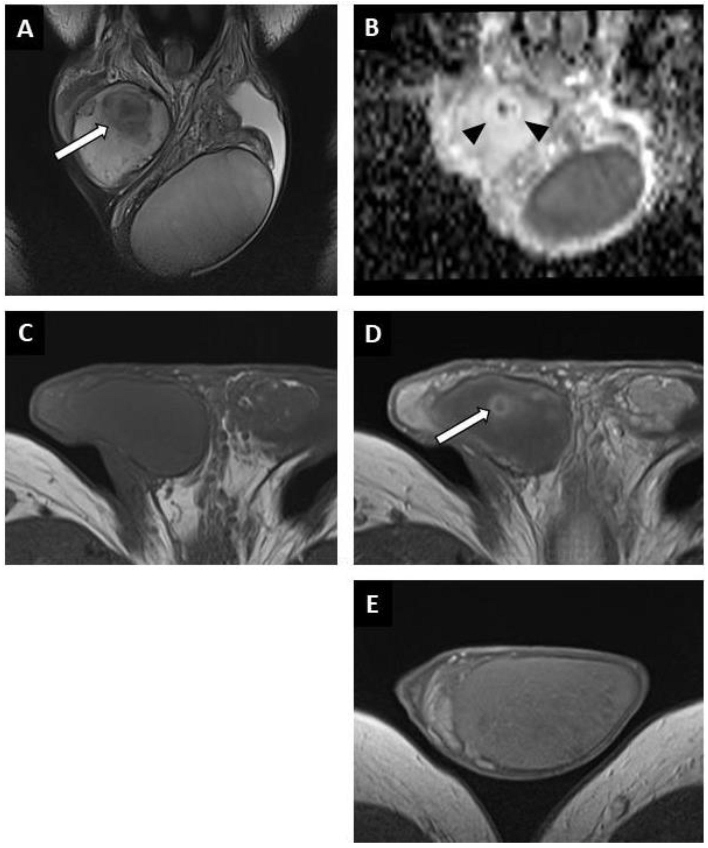 Cancers 14 04013 g004