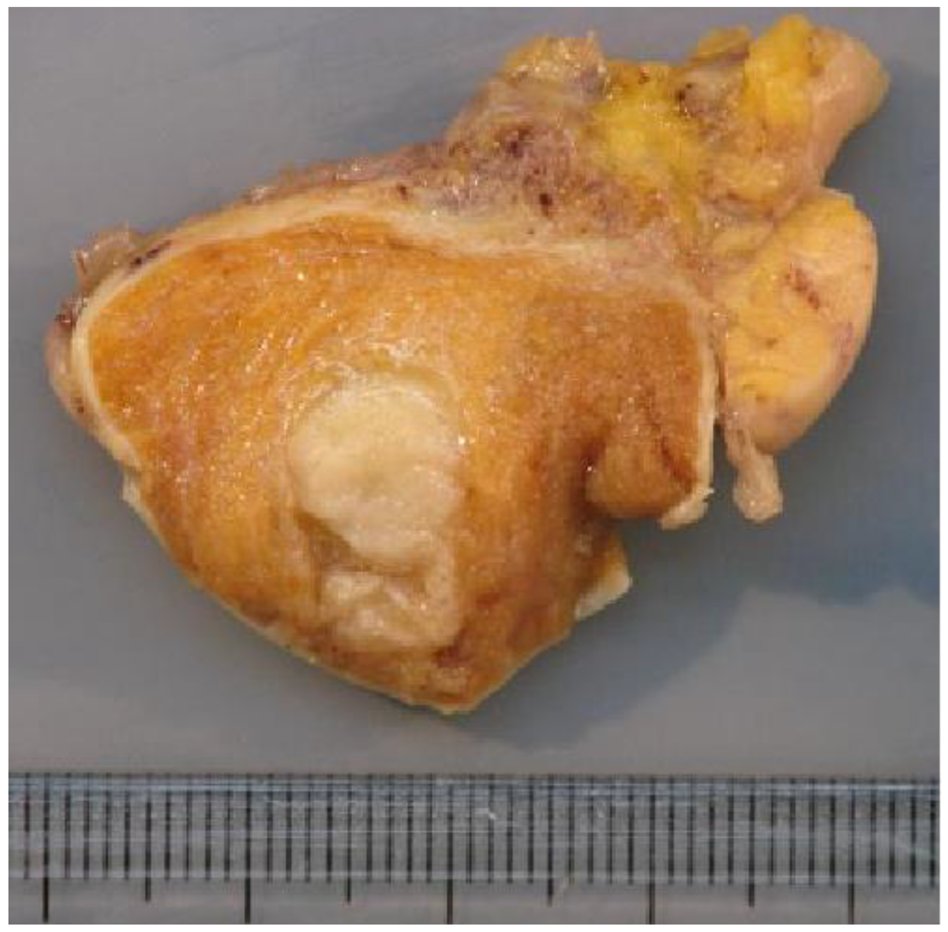 Cancers 14 04013 g005