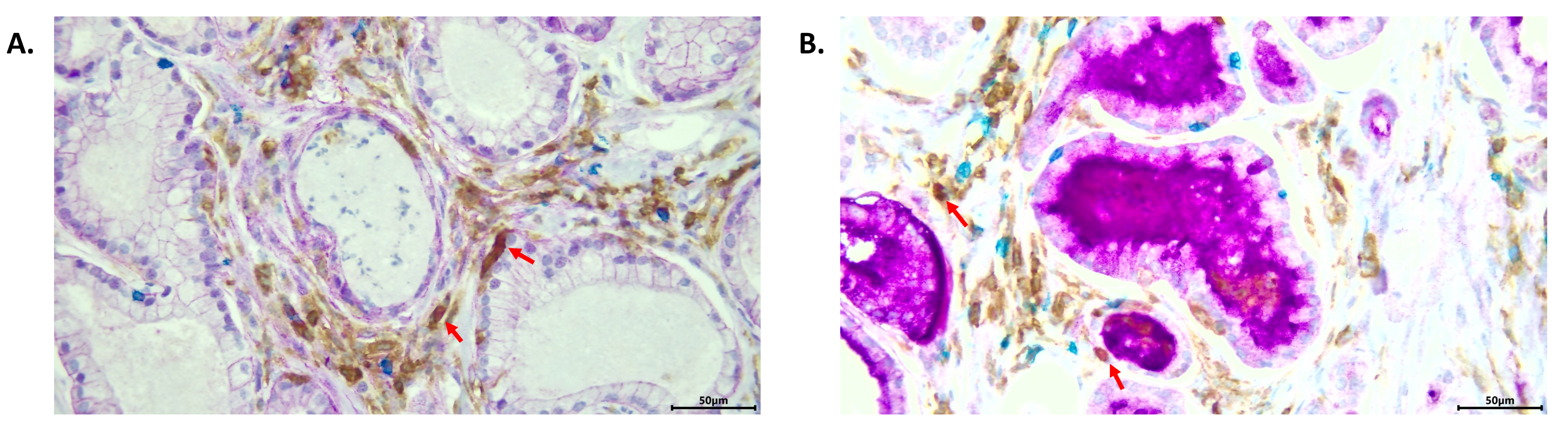 Cancers 14 04034 g003