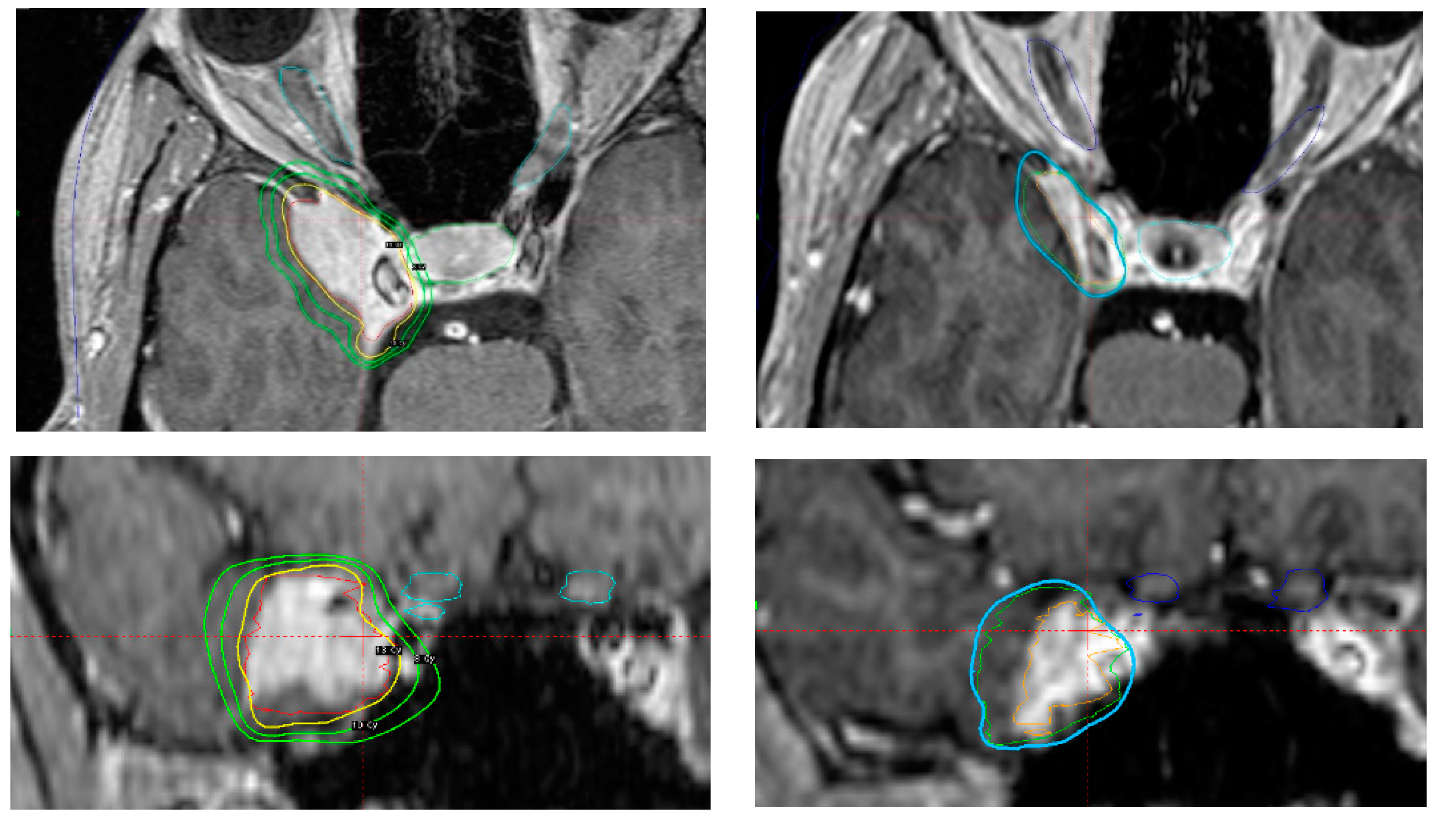 Cancers 14 04047 g005