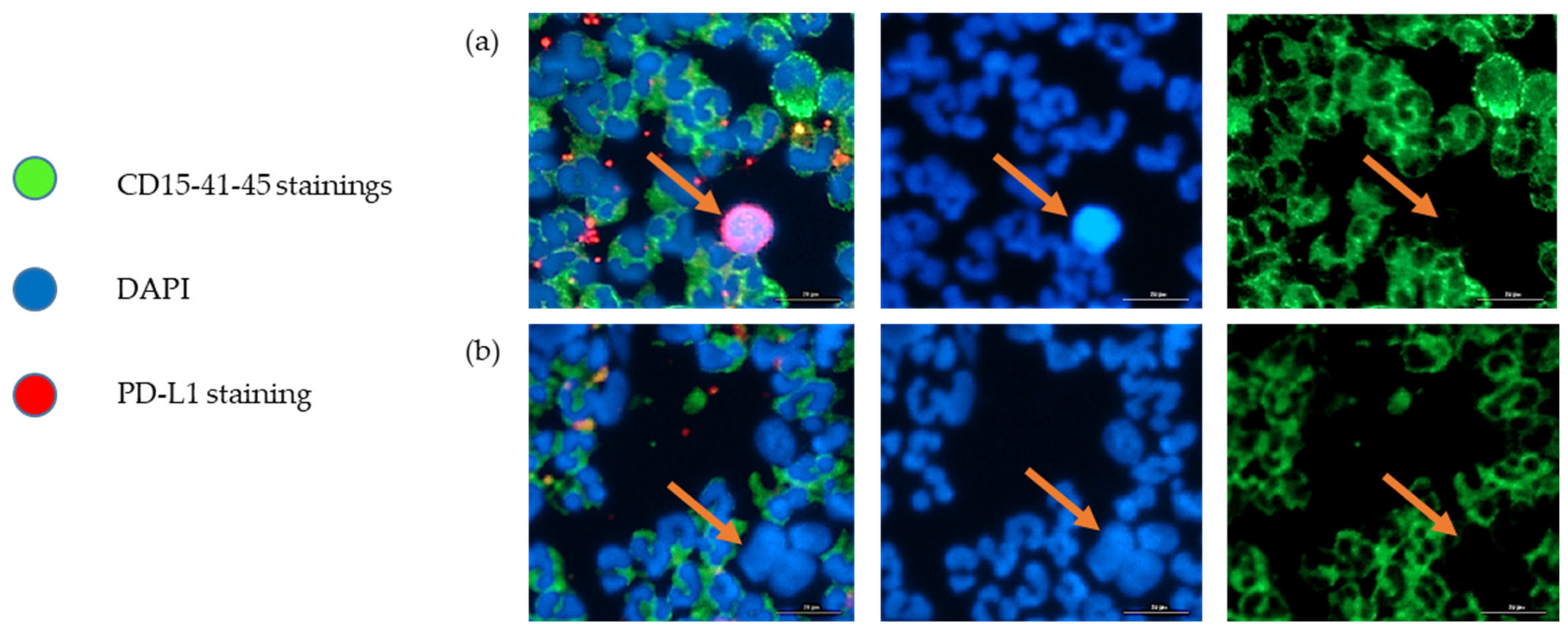 Cancers 14 04085 g003