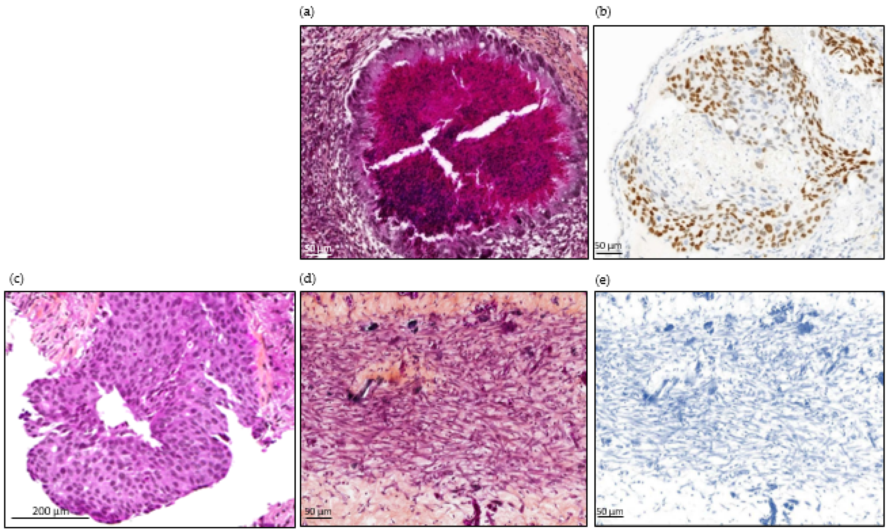 Cancers 14 04085 g005