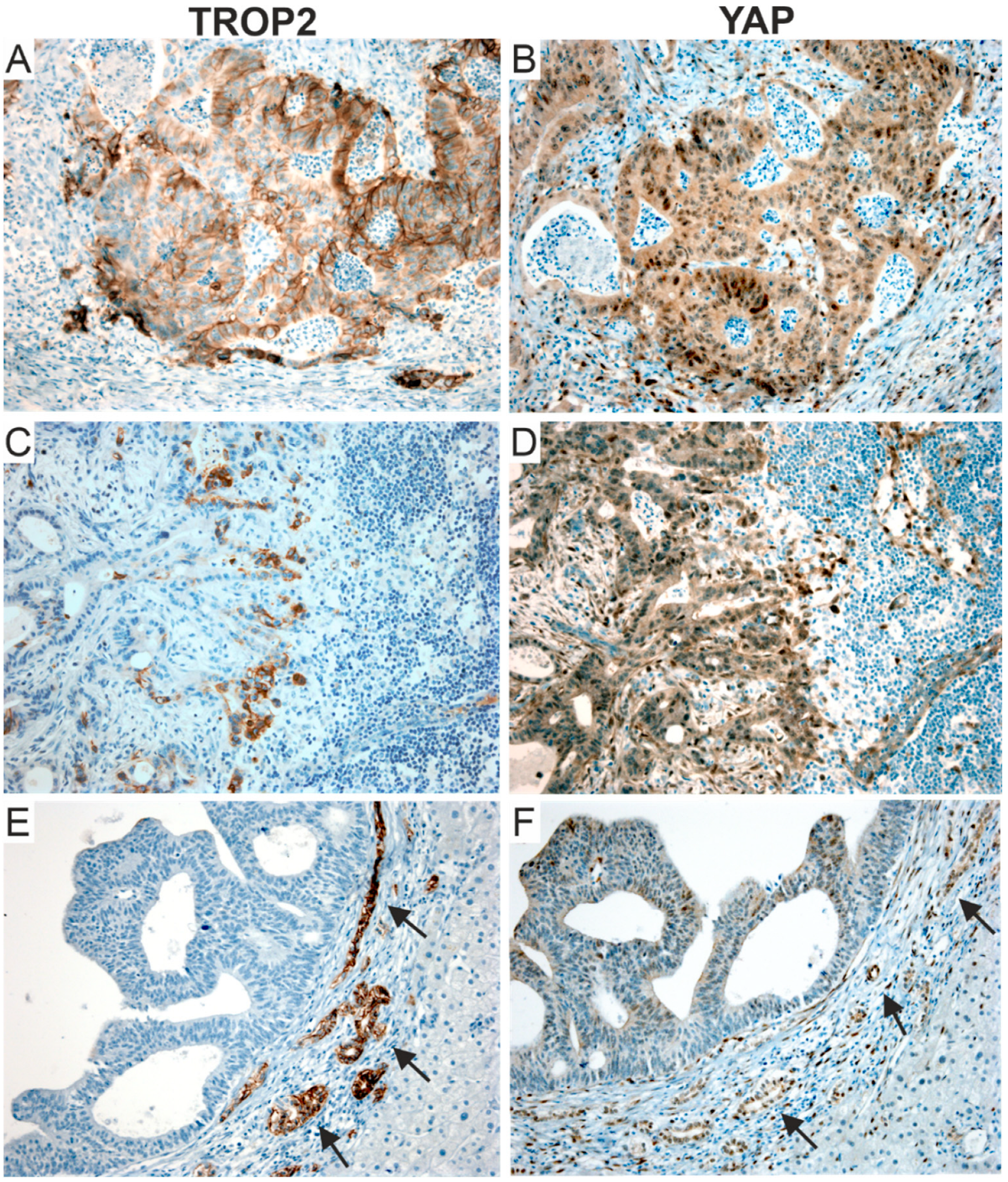 Cancers 14 04137 g009