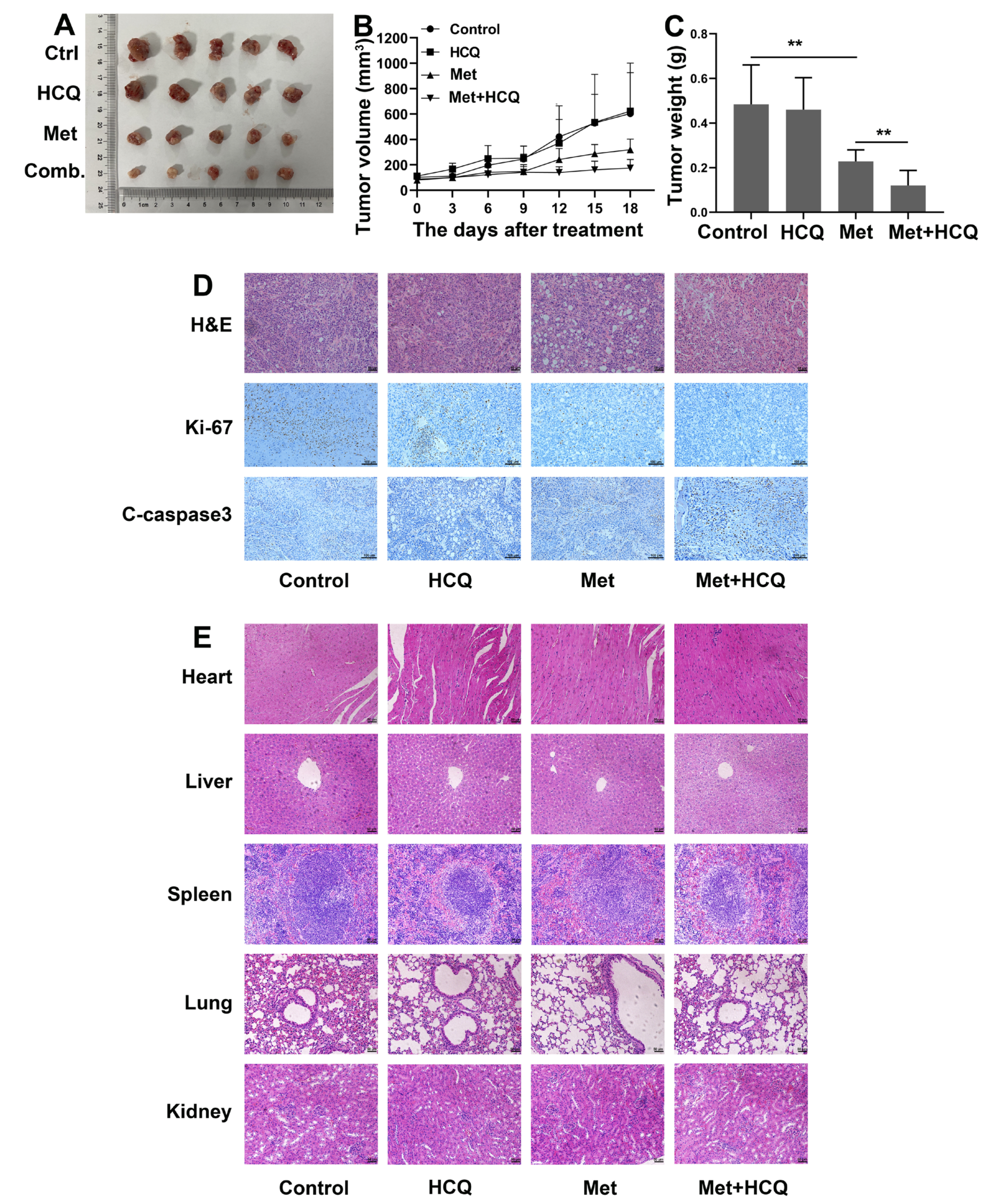 Cancers 14 04185 g007