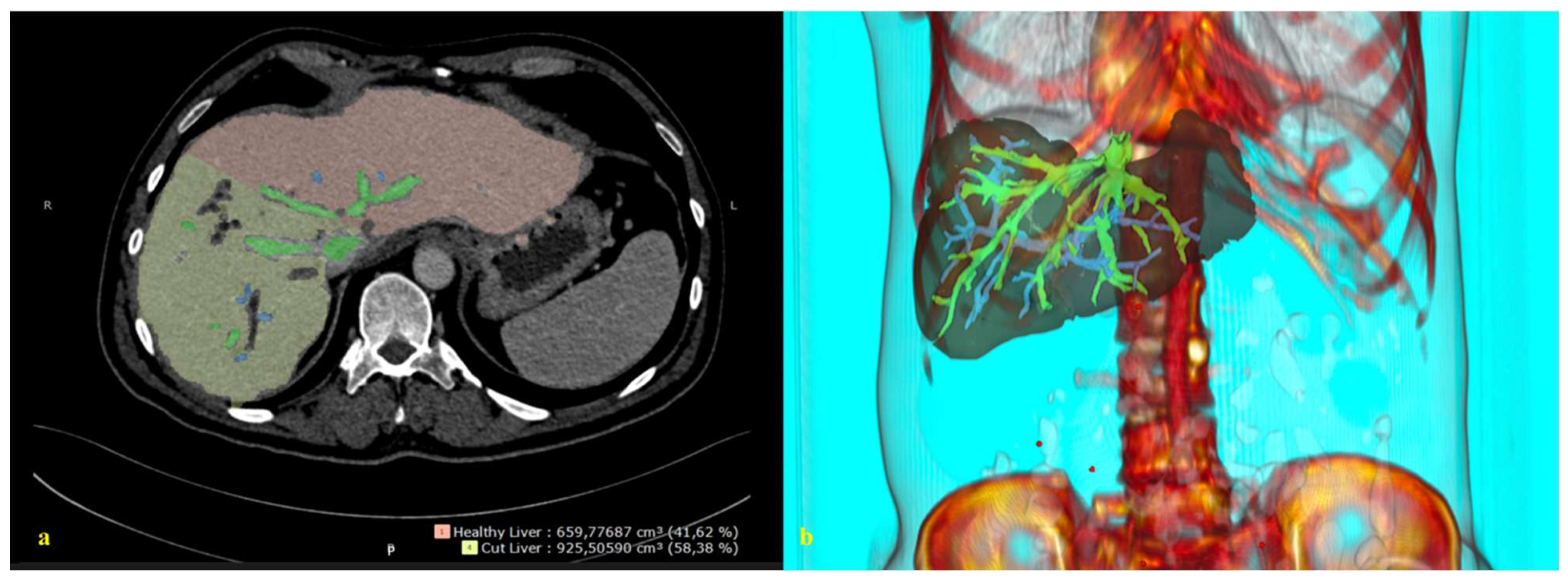 Cancers 14 04268 g002