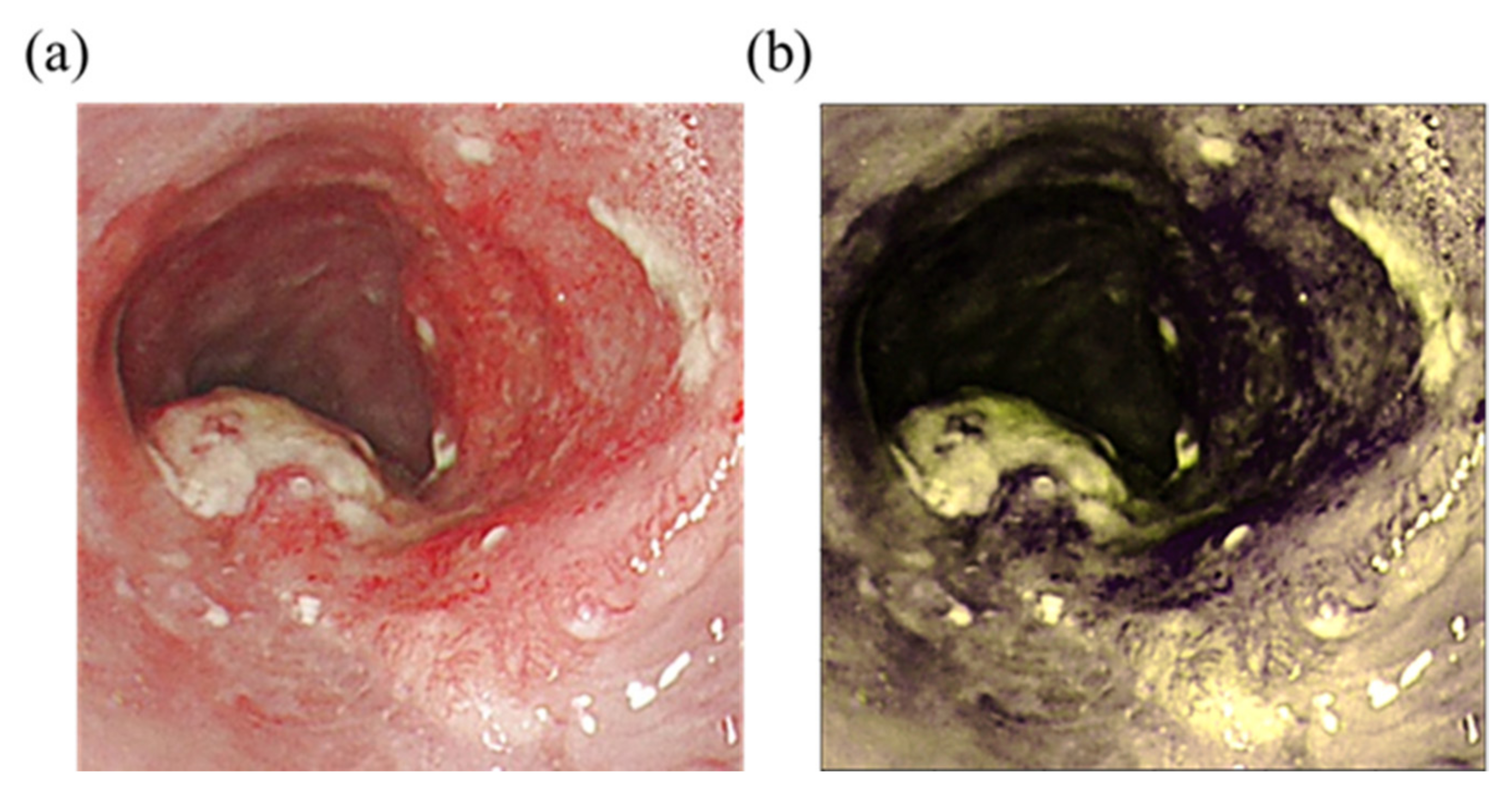 Cancers 14 04292 g002
