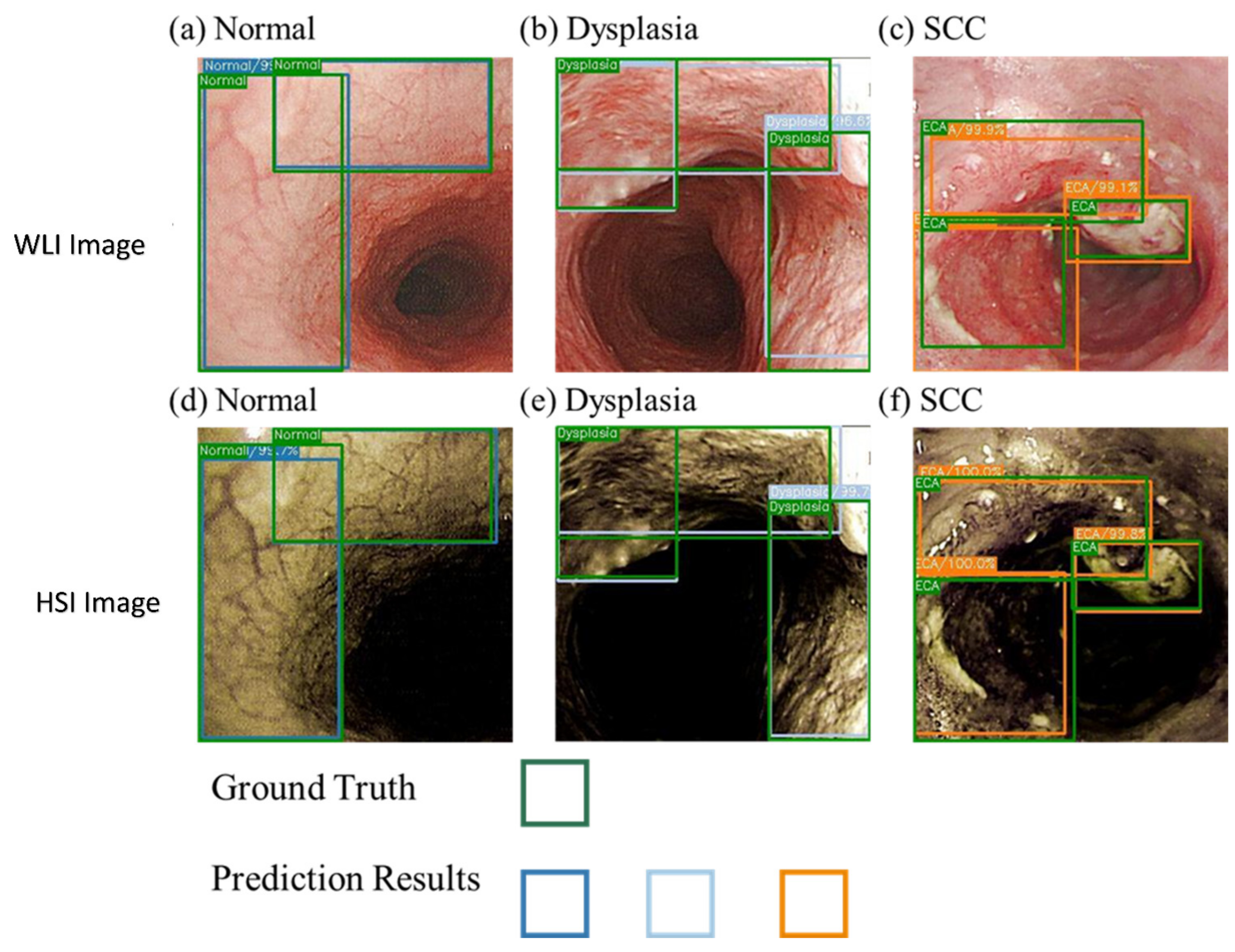 Cancers 14 04292 g004