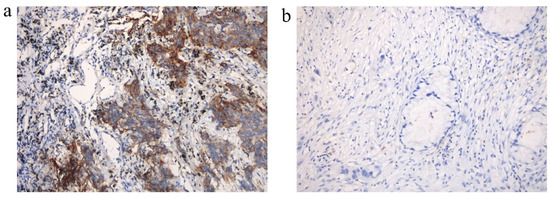 Cancers 14 04333 g0a2 550