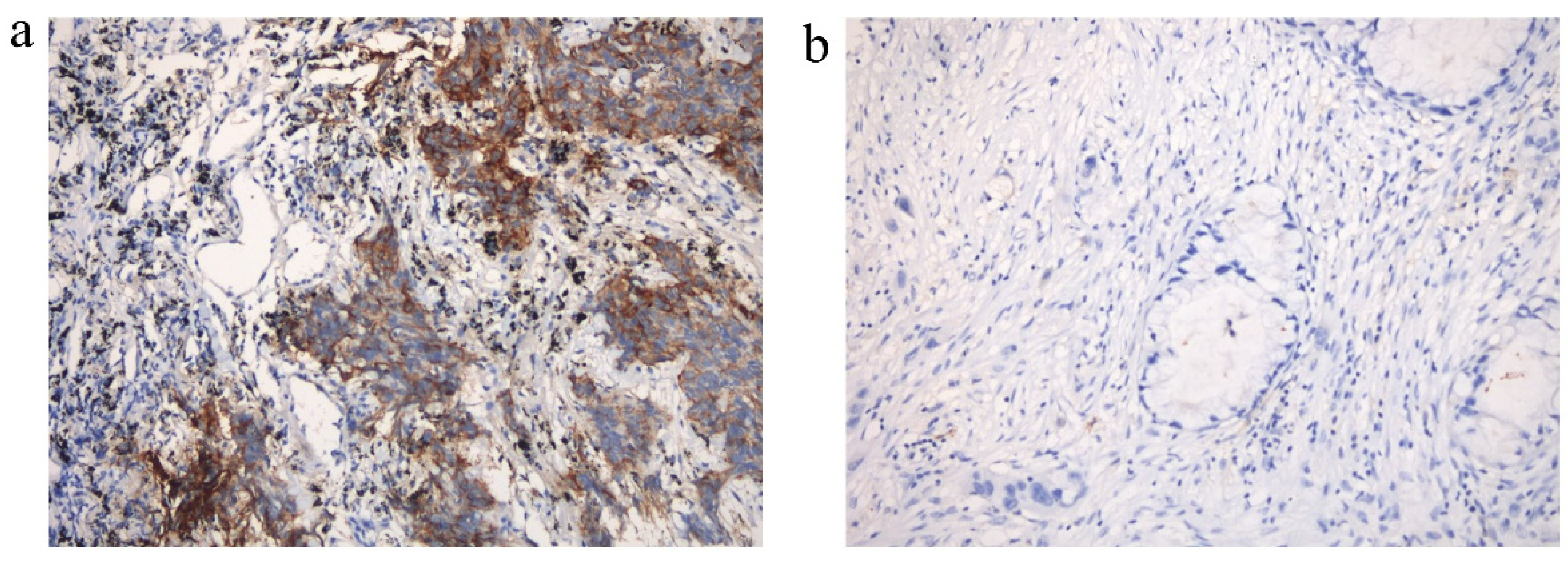 Cancers 14 04333 g0a2