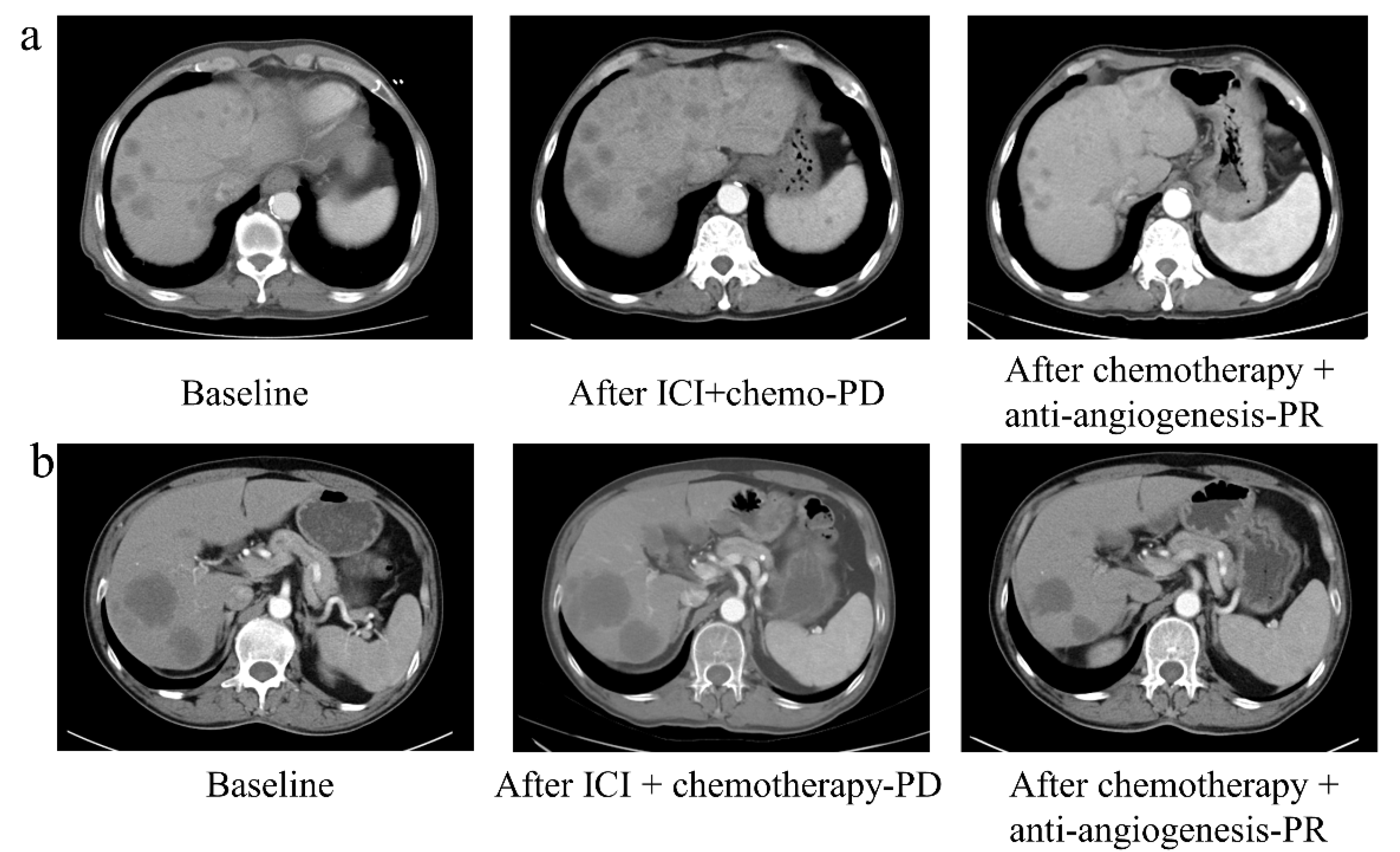 Cancers 14 04333 g0a3