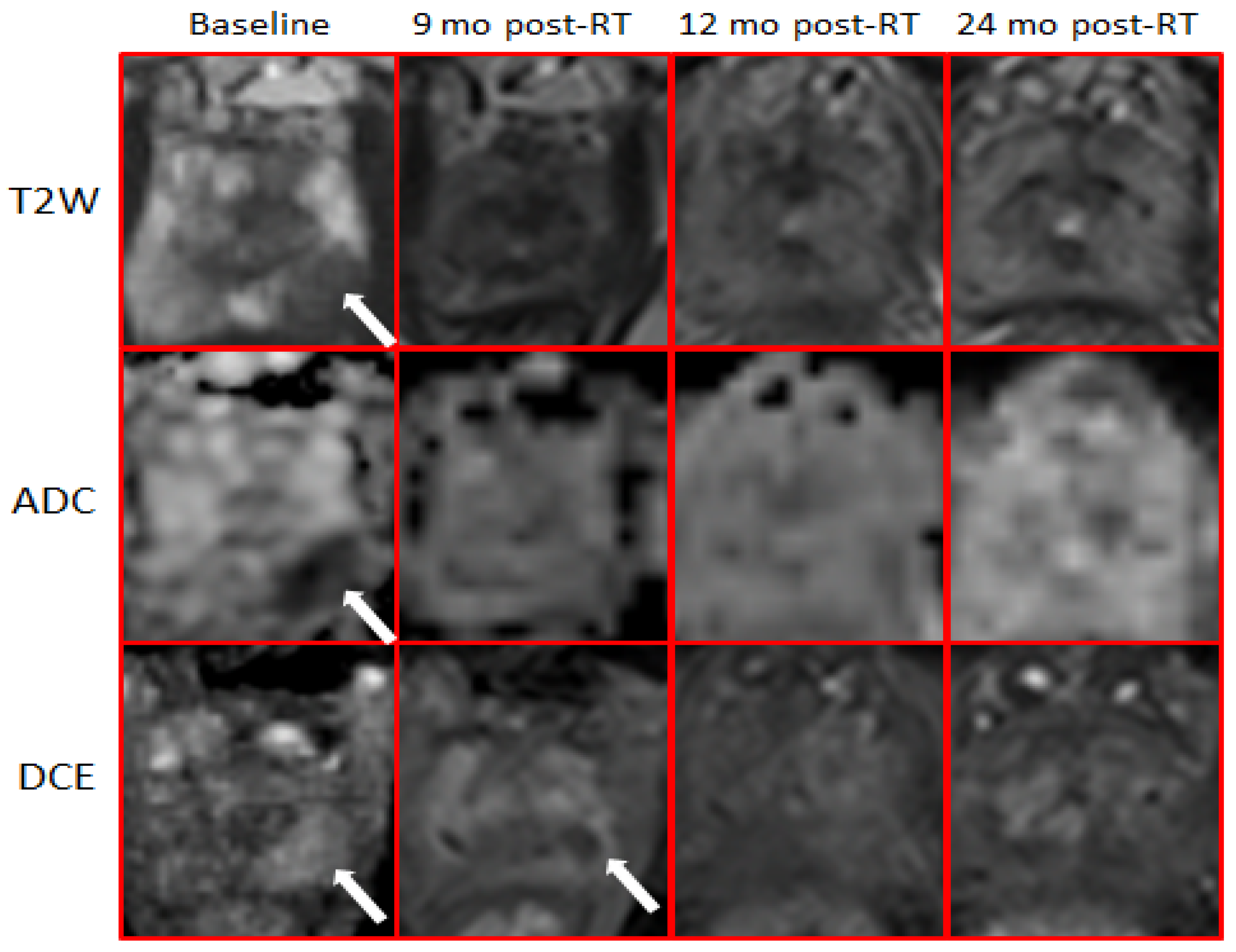 Cancers 14 04475 g002