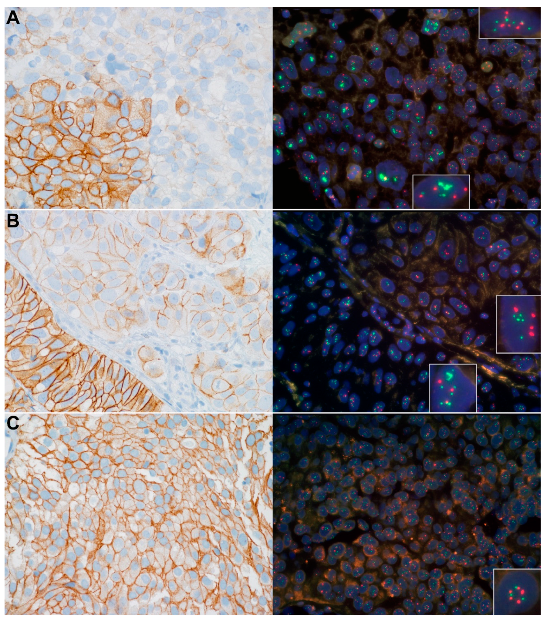 Cancers 14 04570 g001
