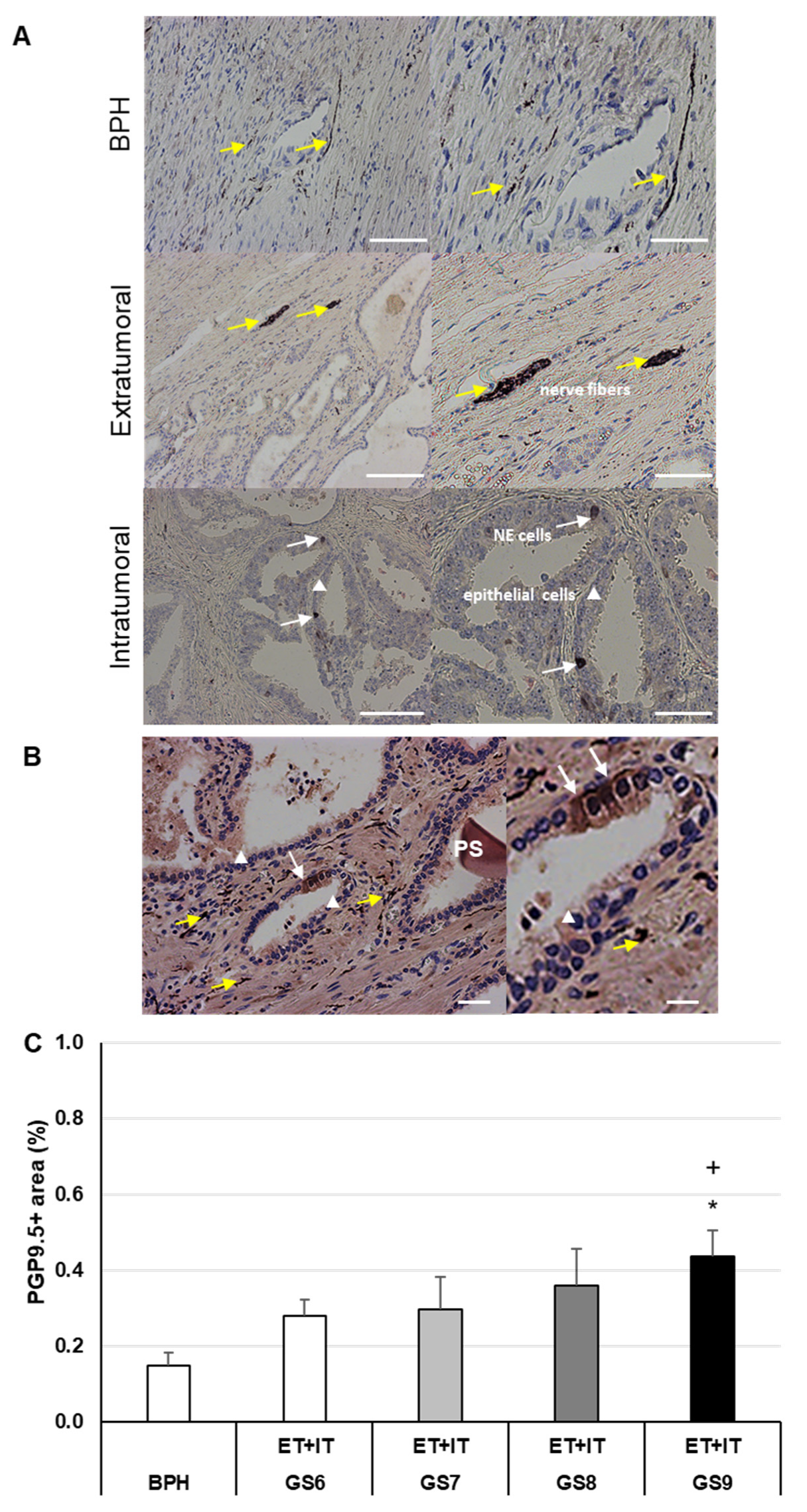 Cancers 14 04591 g001