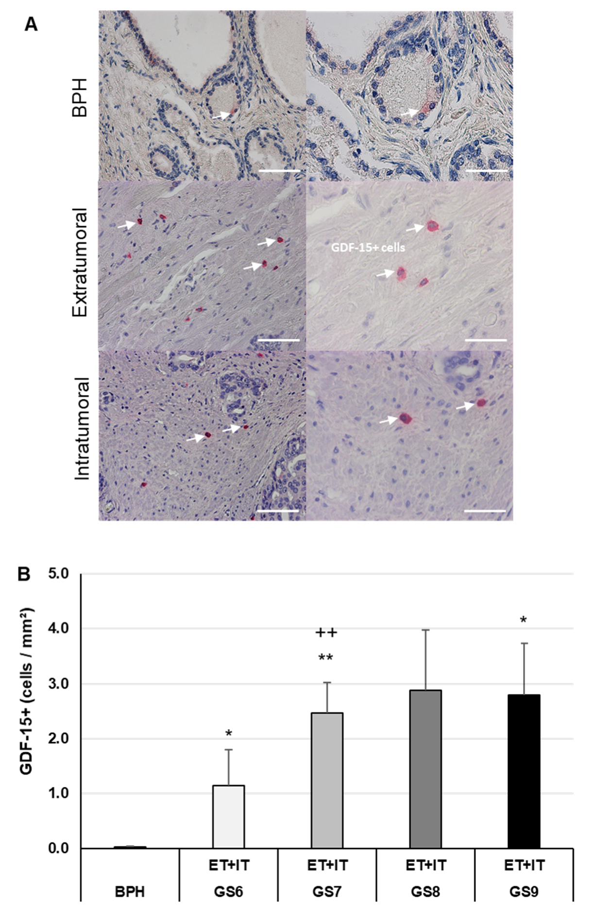 Cancers 14 04591 g002