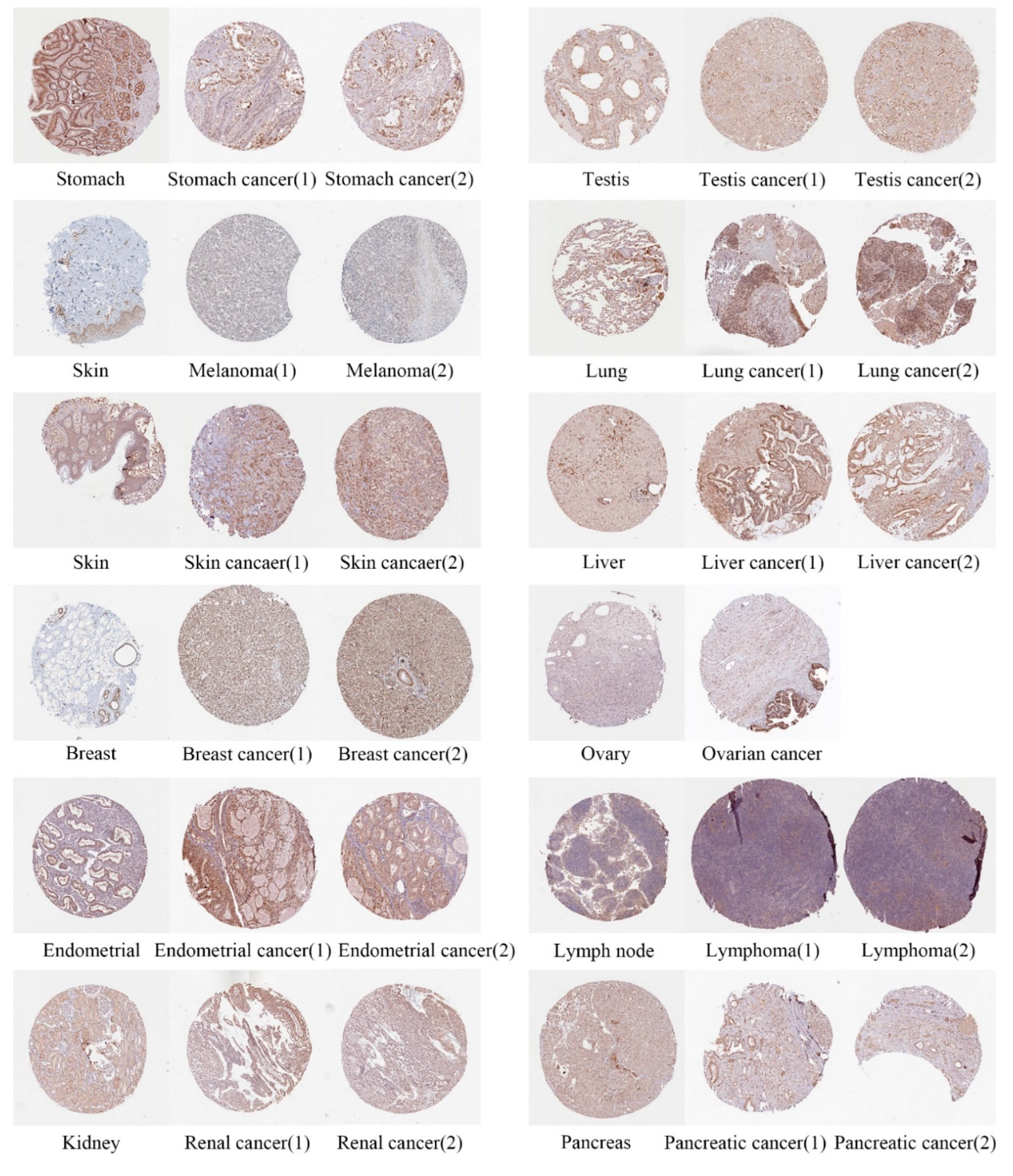 Cancers 14 04595 g002 Cancers 14 04595 g002