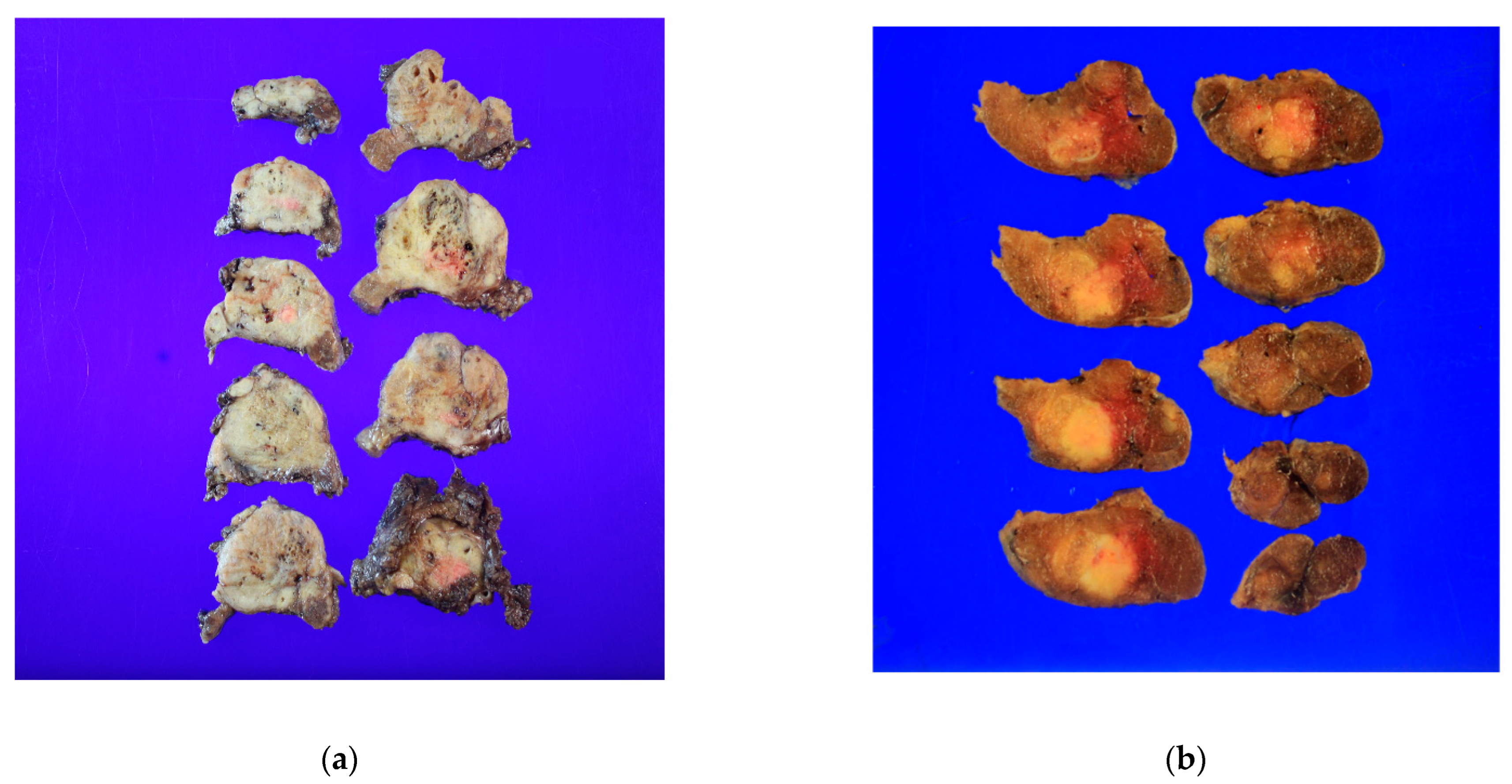 Cancers 14 04615 g001 Cancers 14 04615 g001