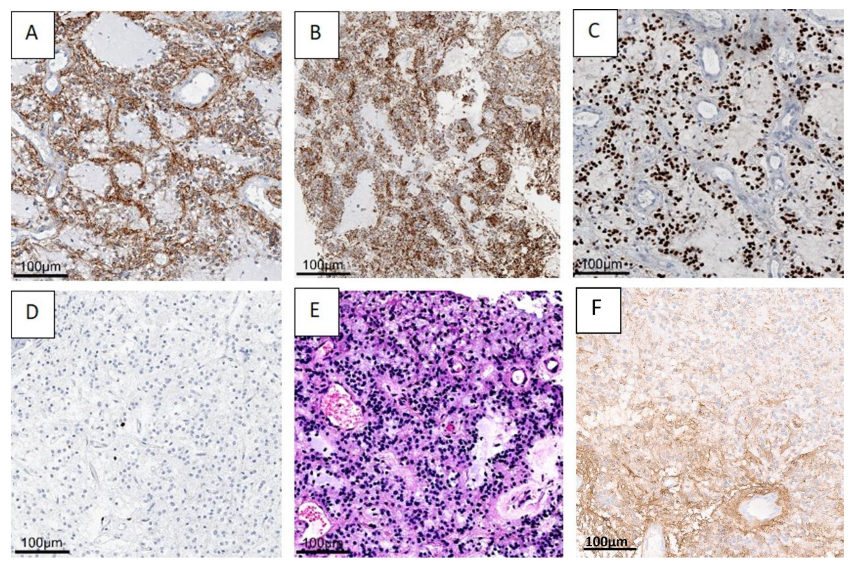 Cancers 14 04634 g004 Cancers 14 04634 g004