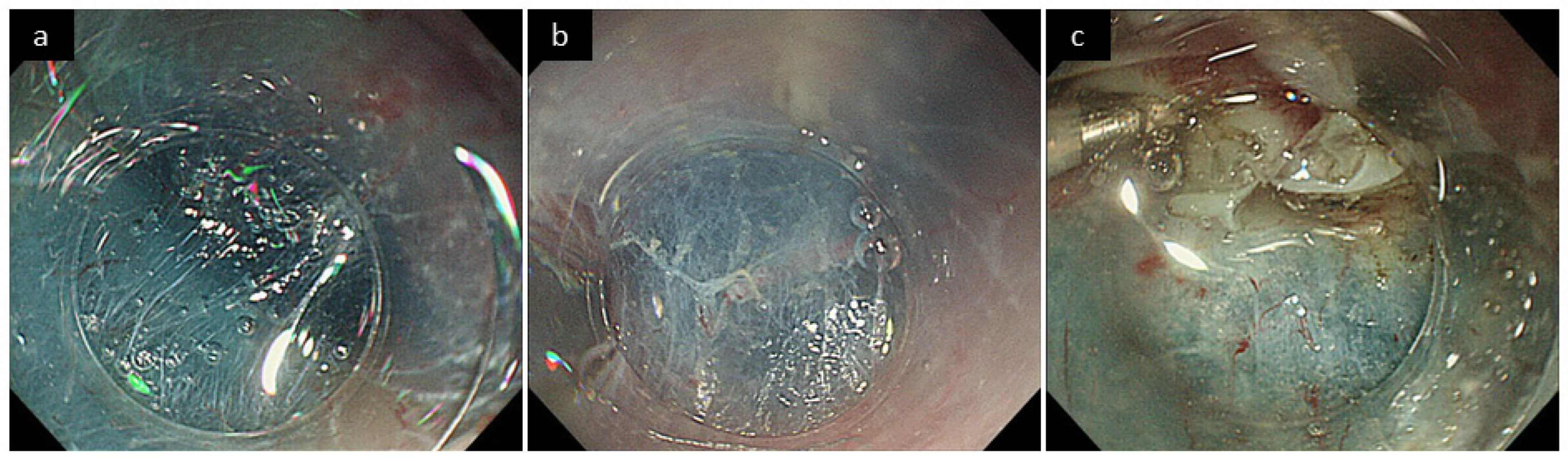 Cancers 14 04685 g001