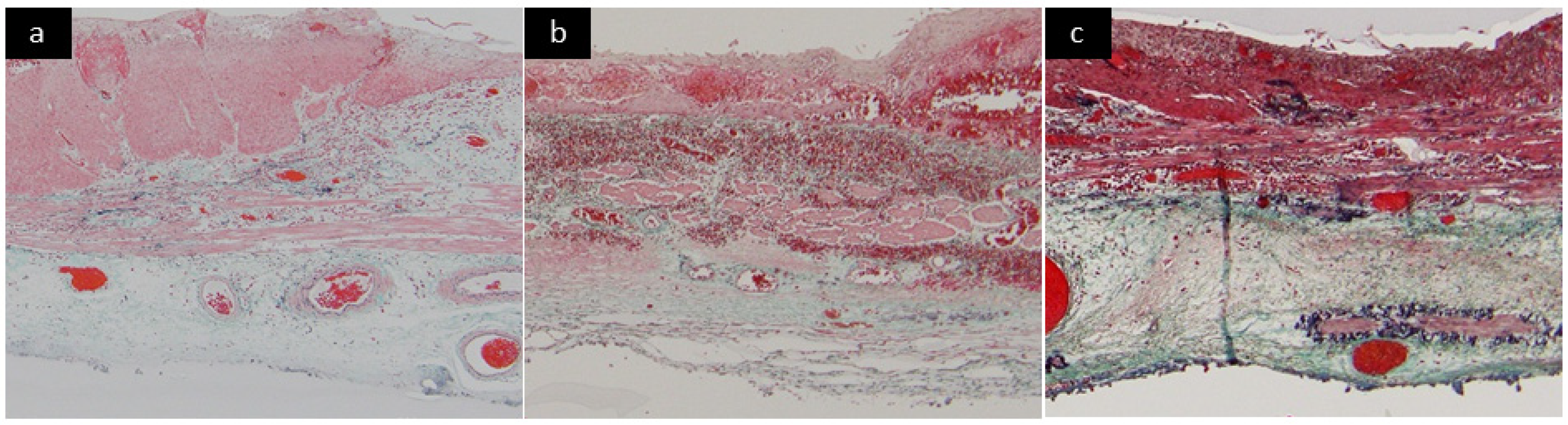 Cancers 14 04685 g002