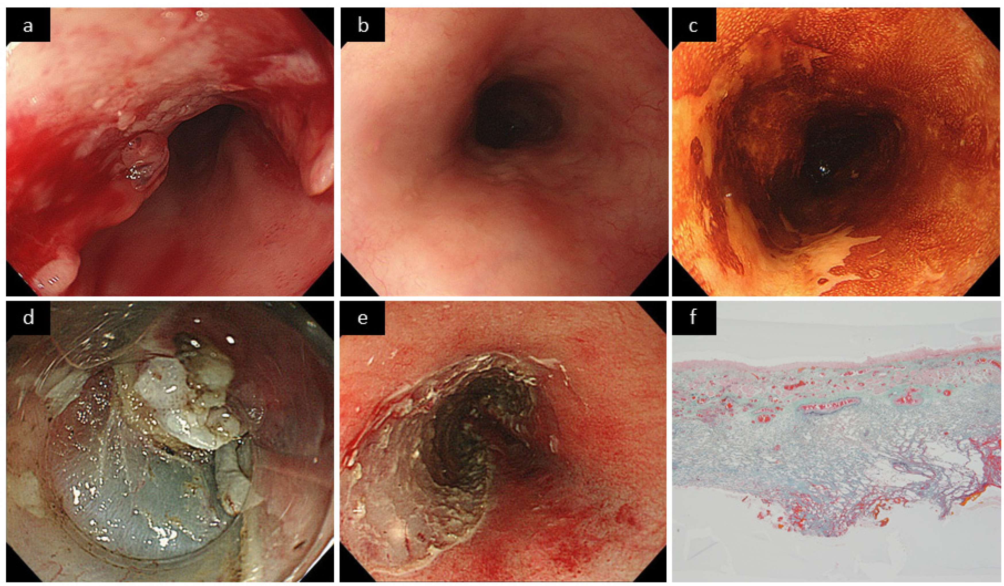 Cancers 14 04685 g003