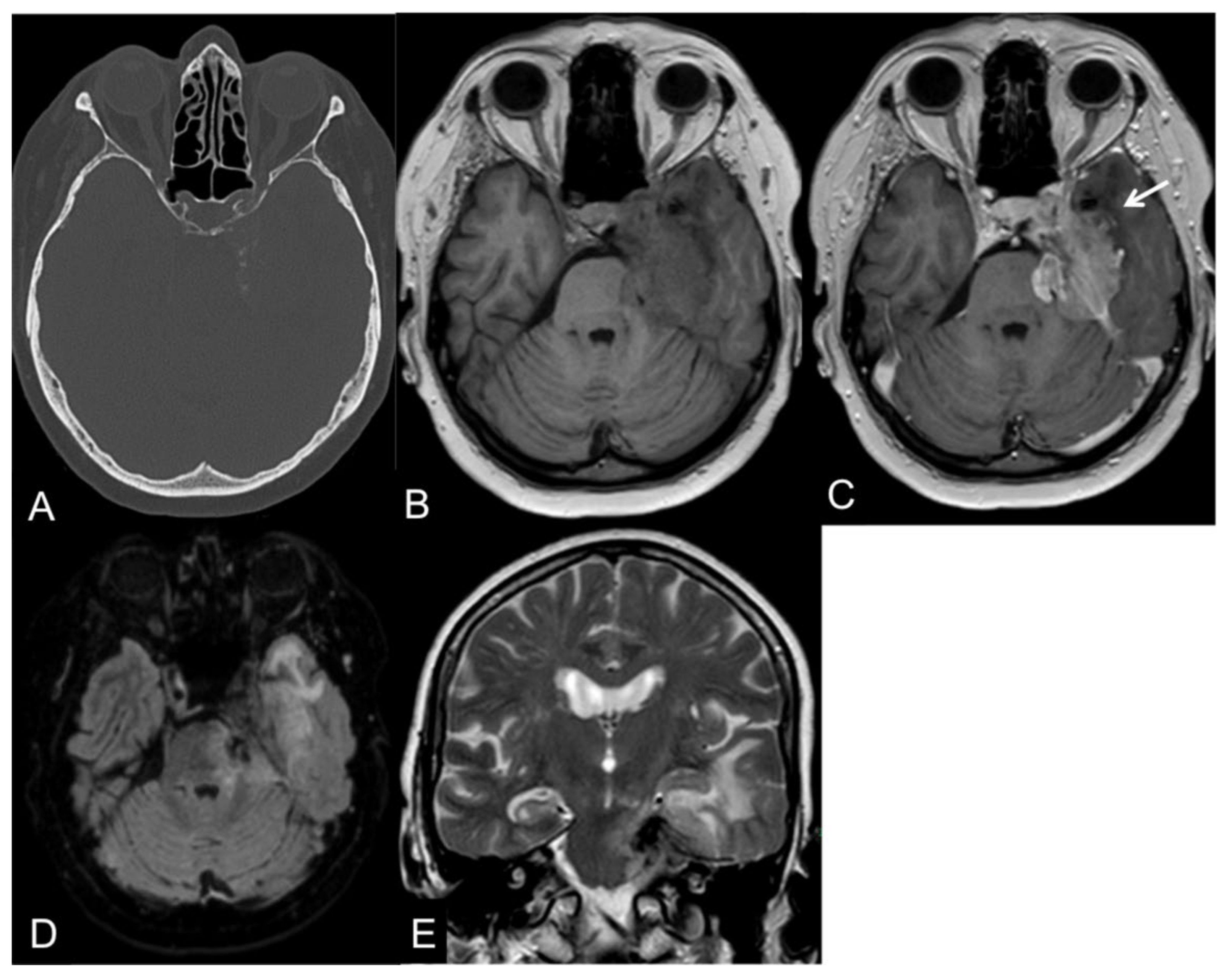 Cancers 14 04689 g001