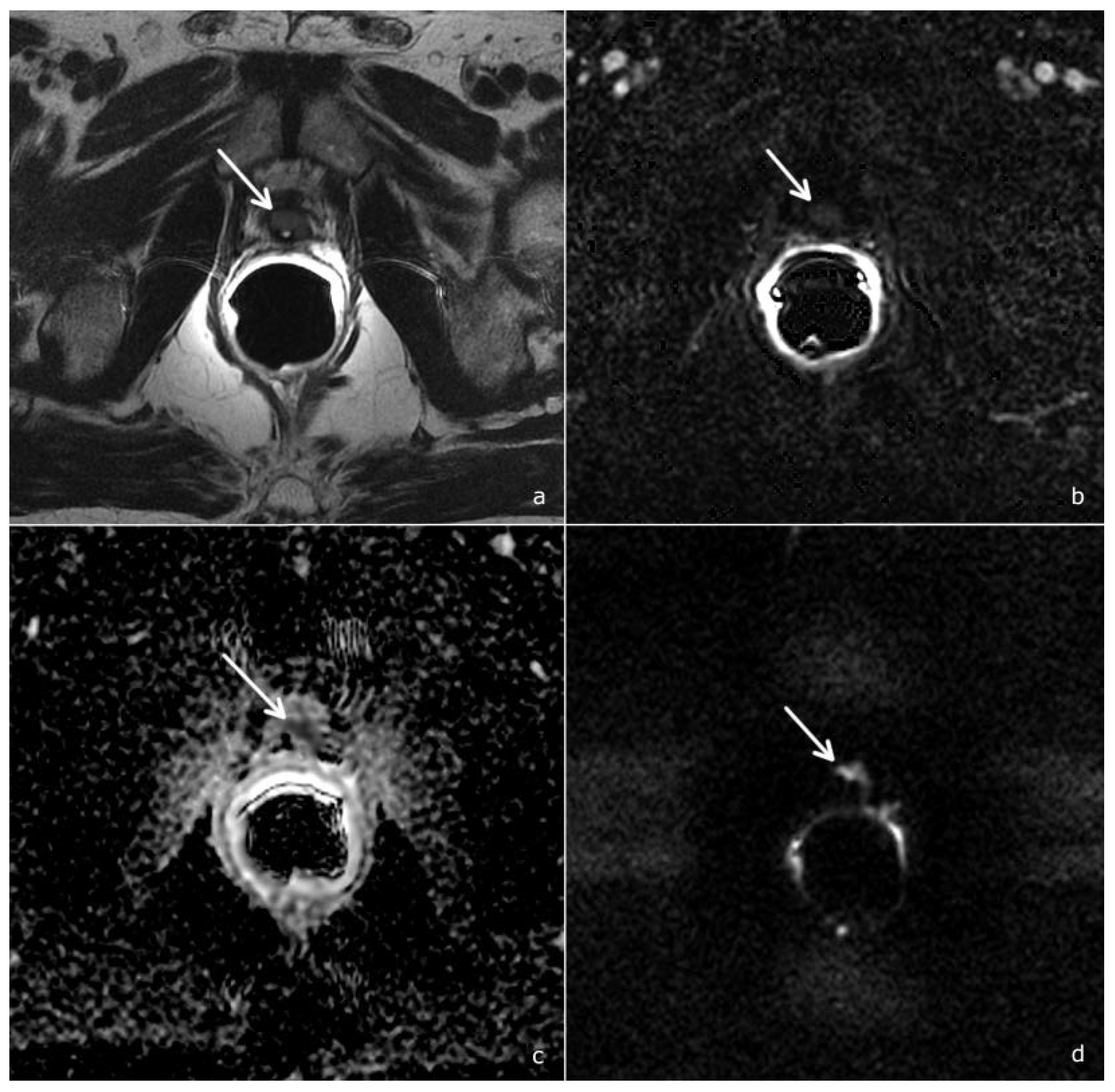 Cancers 14 04725 g004 Cancers 14 04725 g004