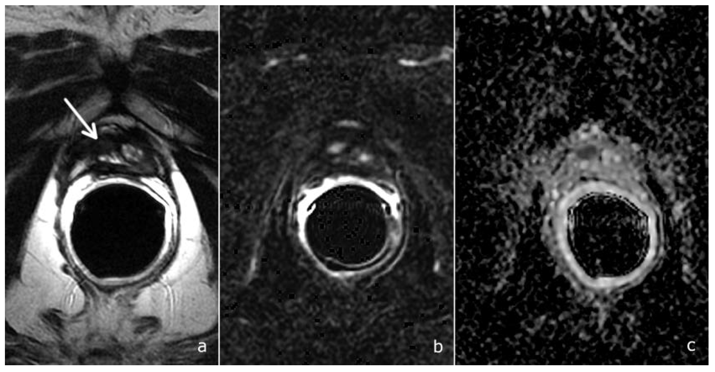 Cancers 14 04725 g005 Cancers 14 04725 g005