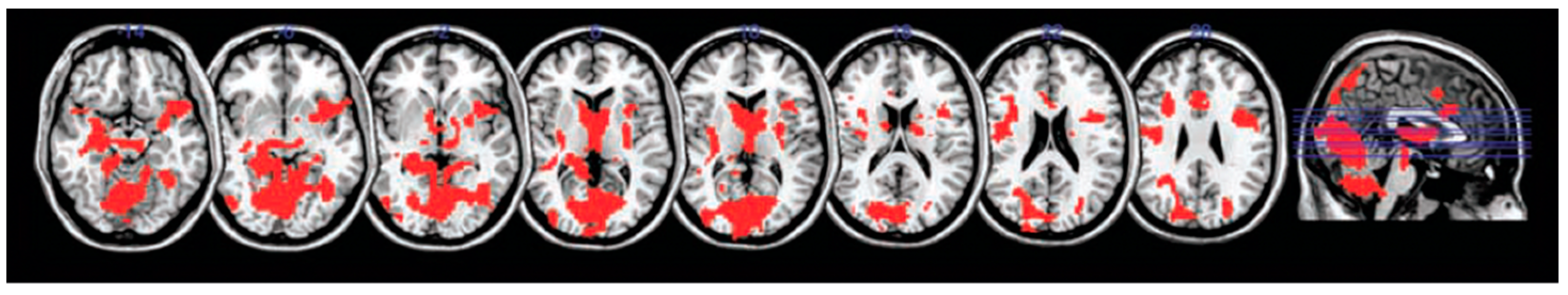 Cancers 14 04752 g003 Cancers 14 04752 g003