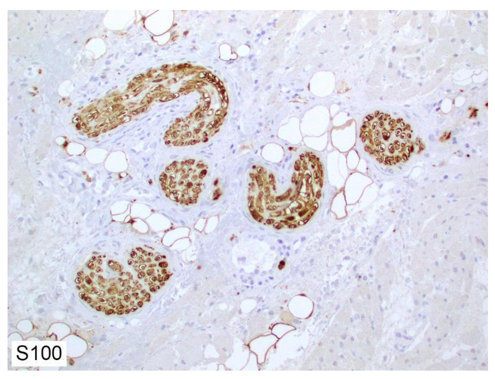 Cancers 14 04817 g003