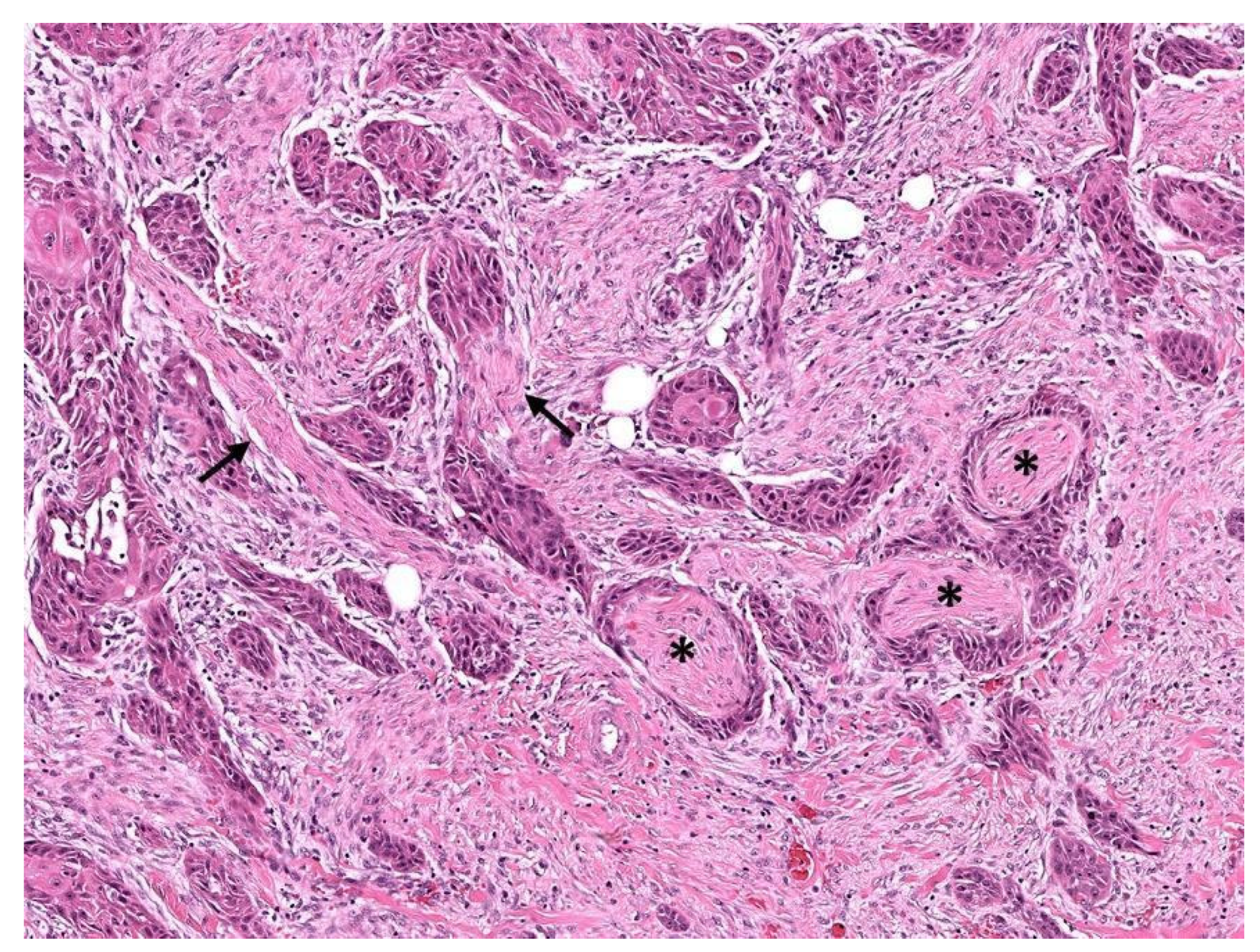 Cancers 14 04817 g004