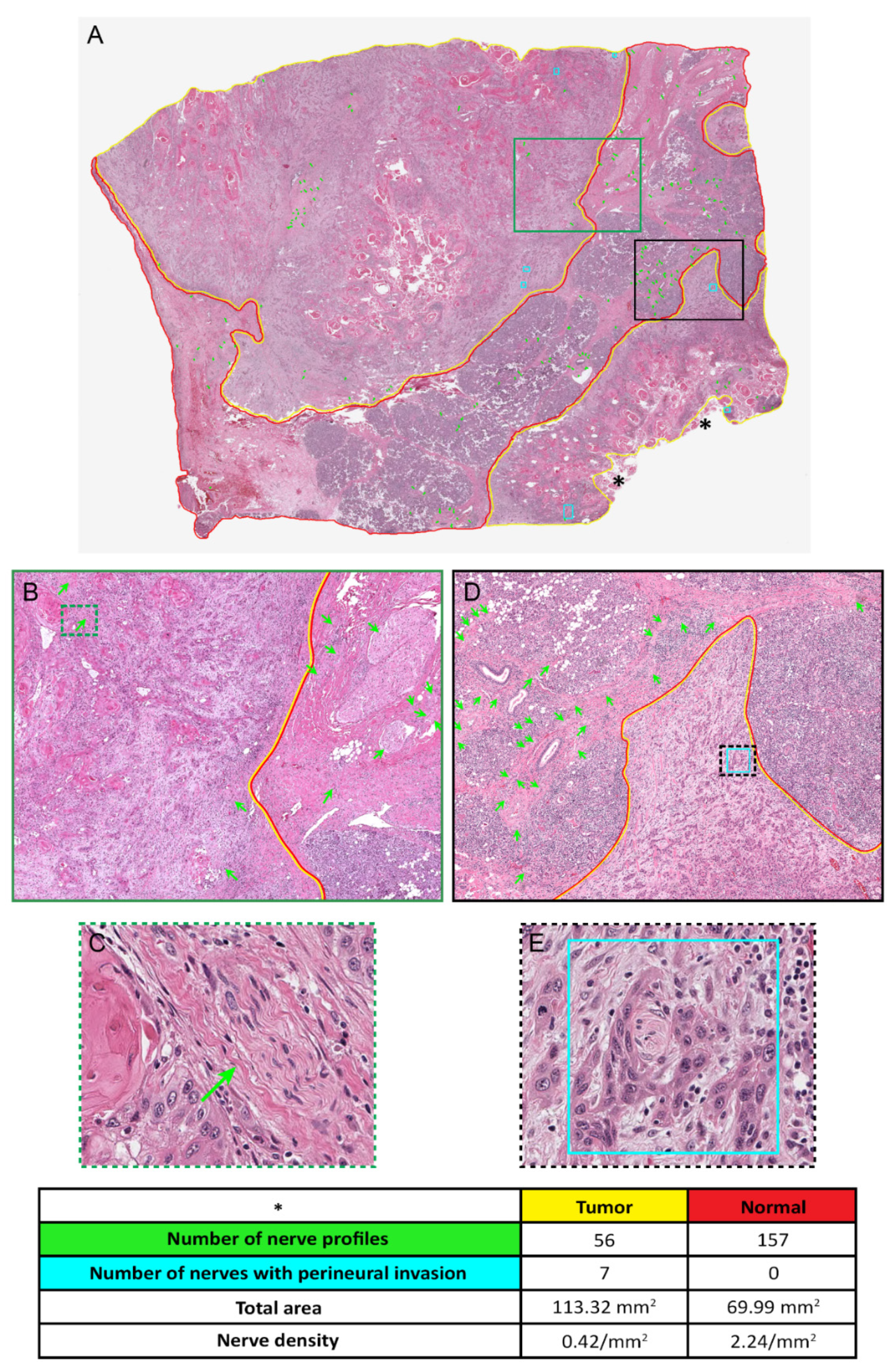 Cancers 14 04817 g005
