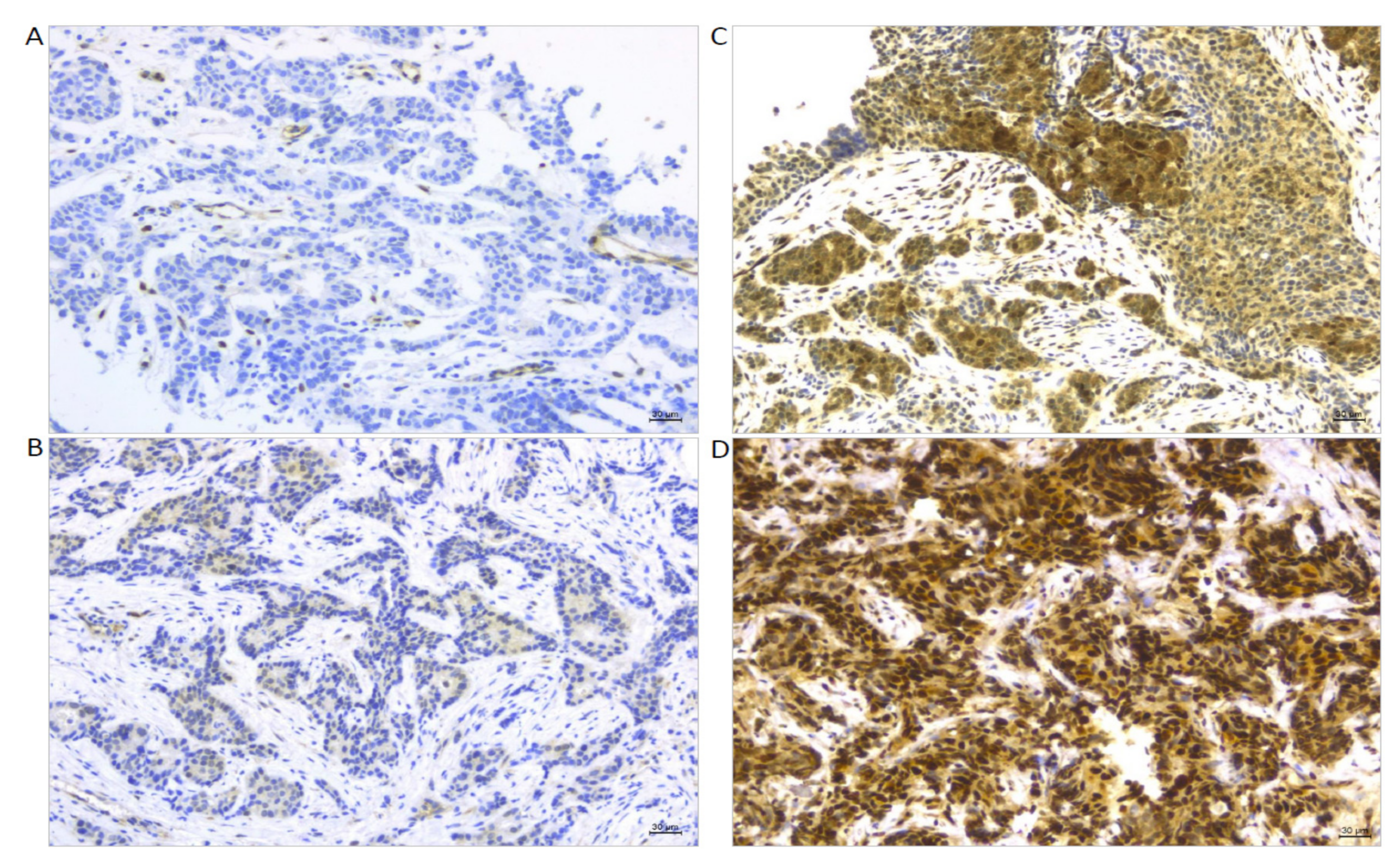 Cancers 14 04835 g005