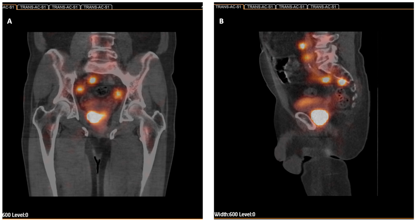 Cancers 14 05012 g001