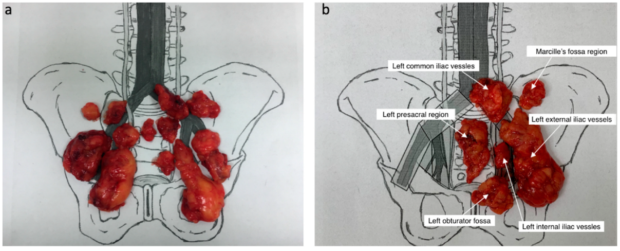 Cancers 14 05012 g002