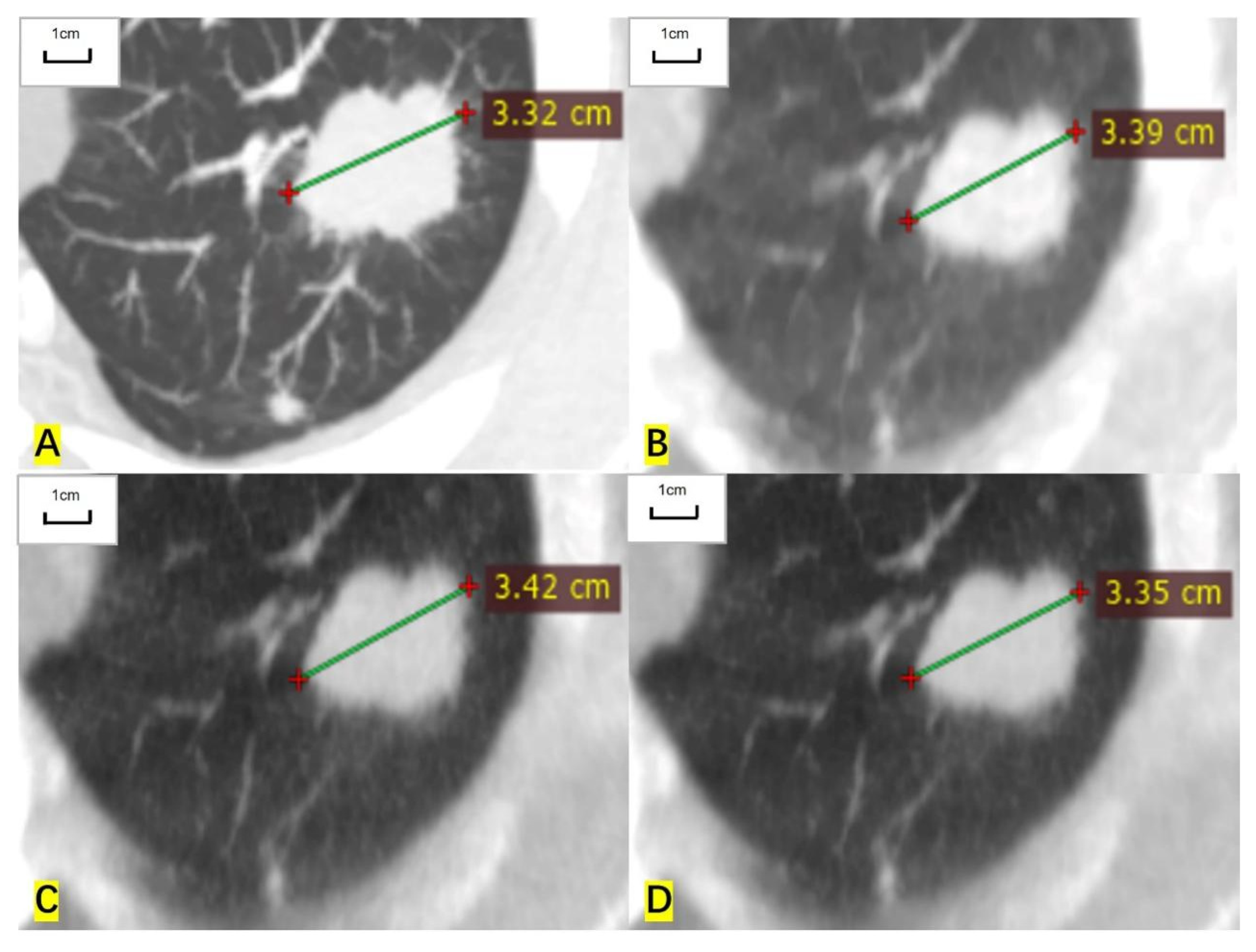 Cancers 14 05016 g001