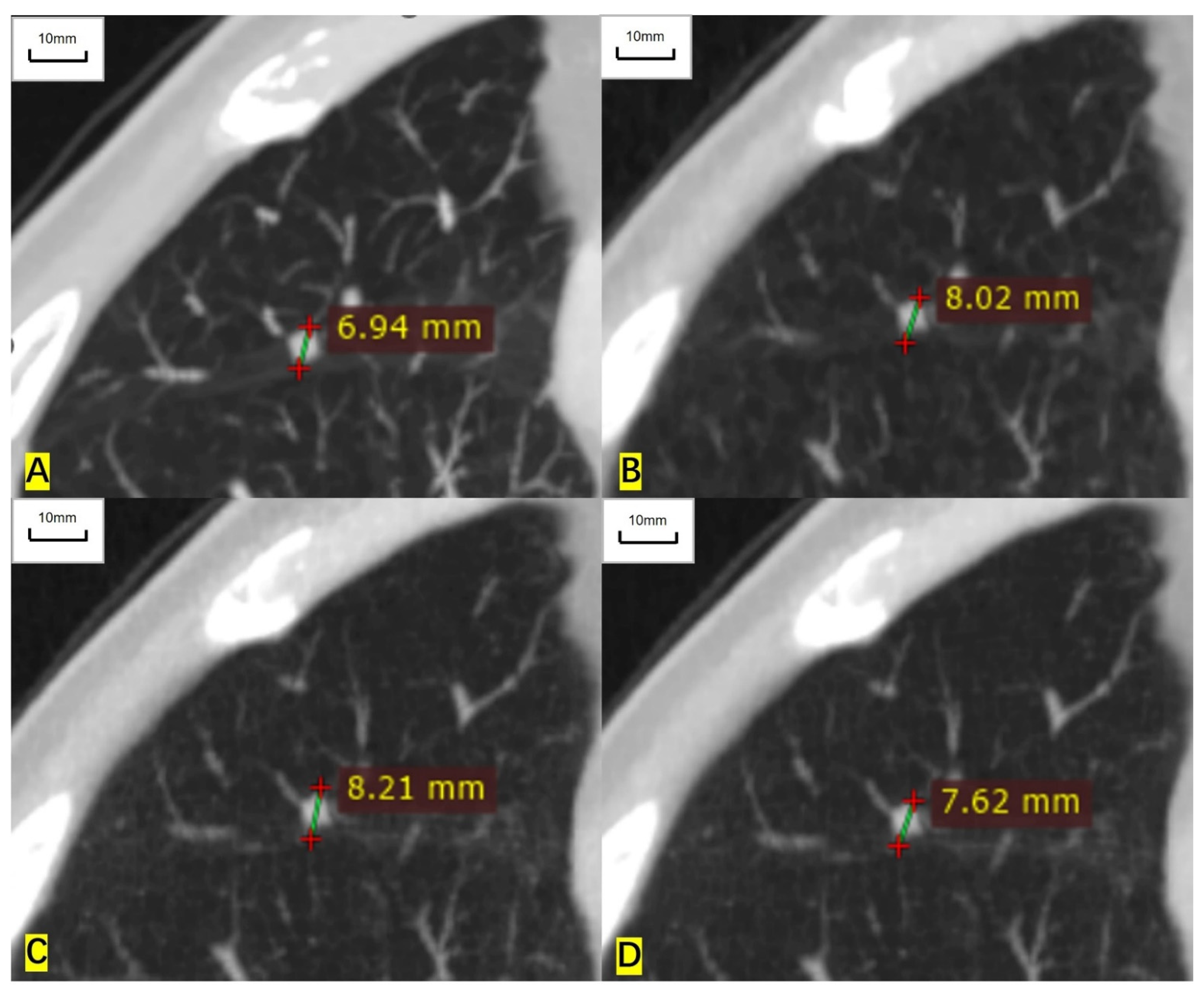 Cancers 14 05016 g004