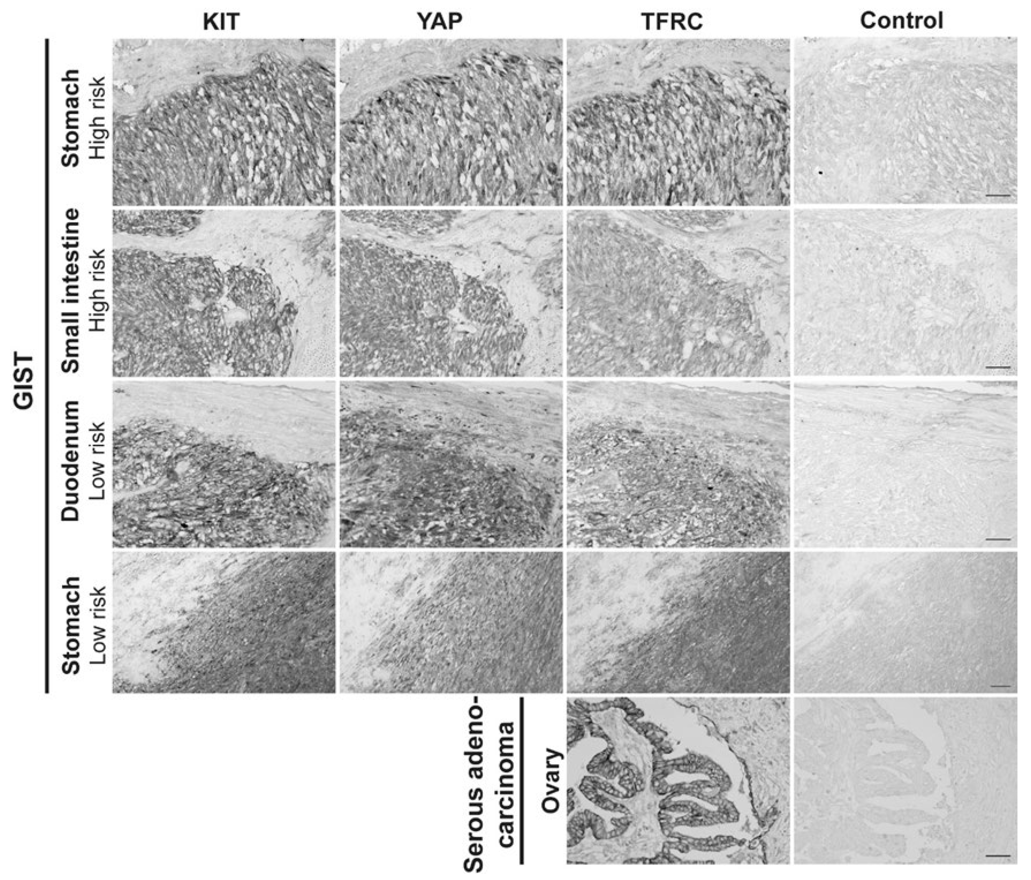 Cancers 14 05050 g008