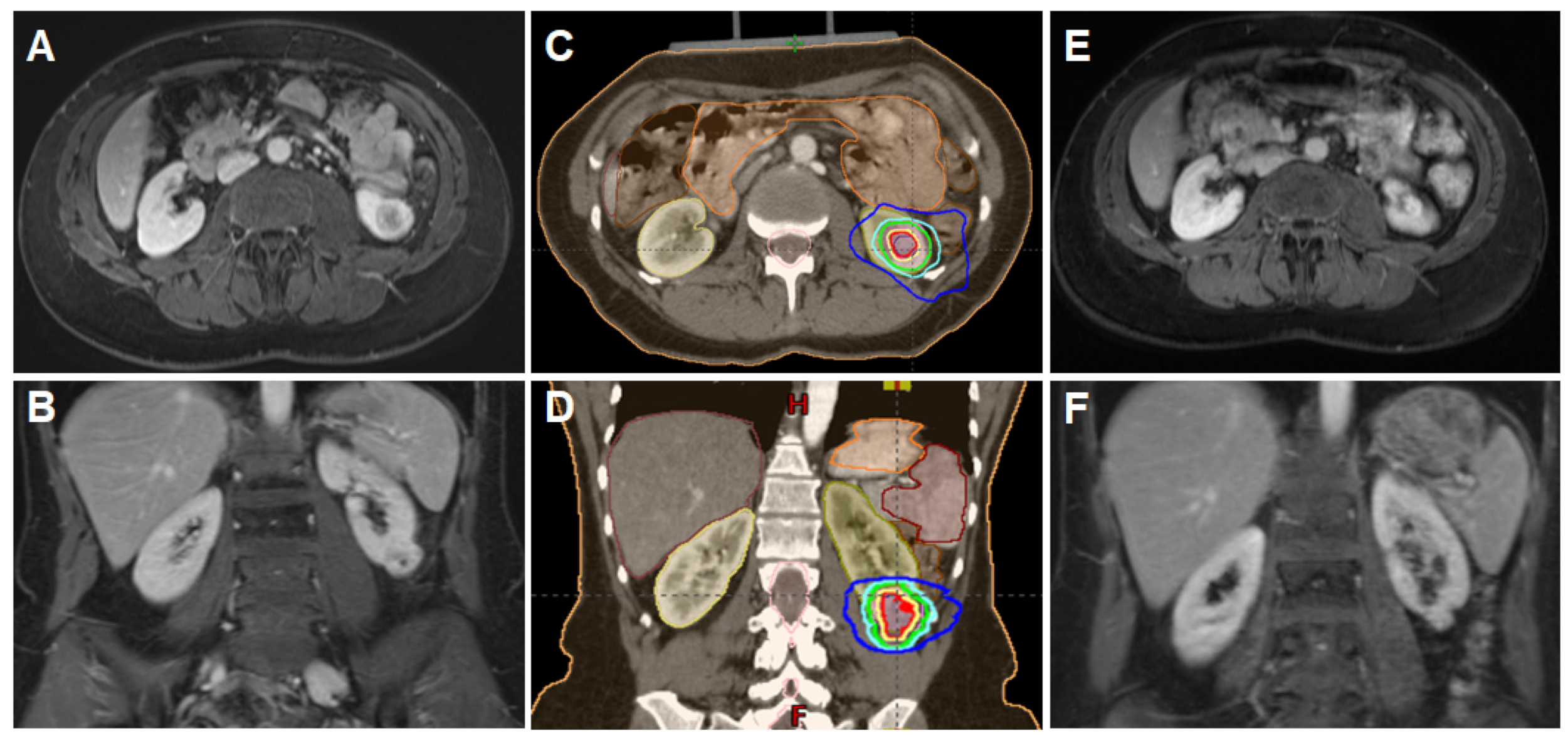 Cancers 14 05069 g001