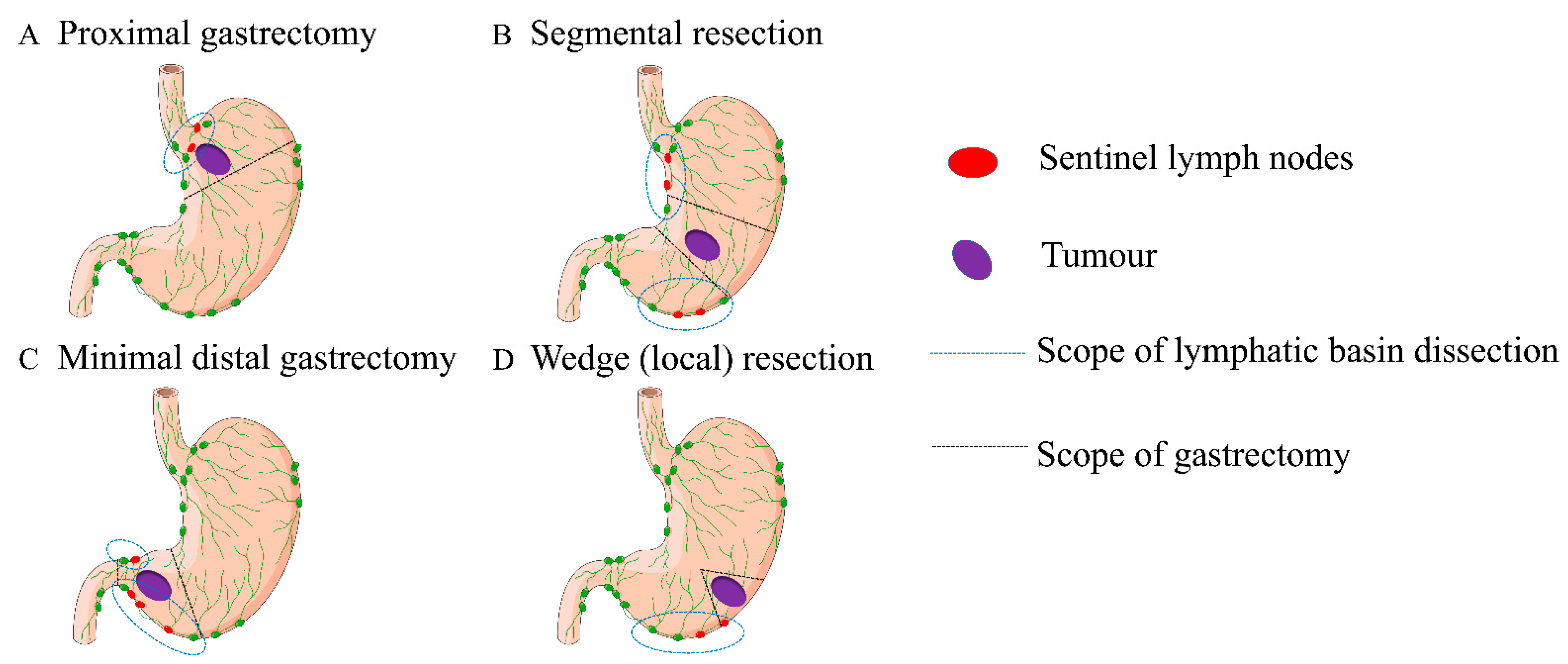 Cancers 14 05143 g002