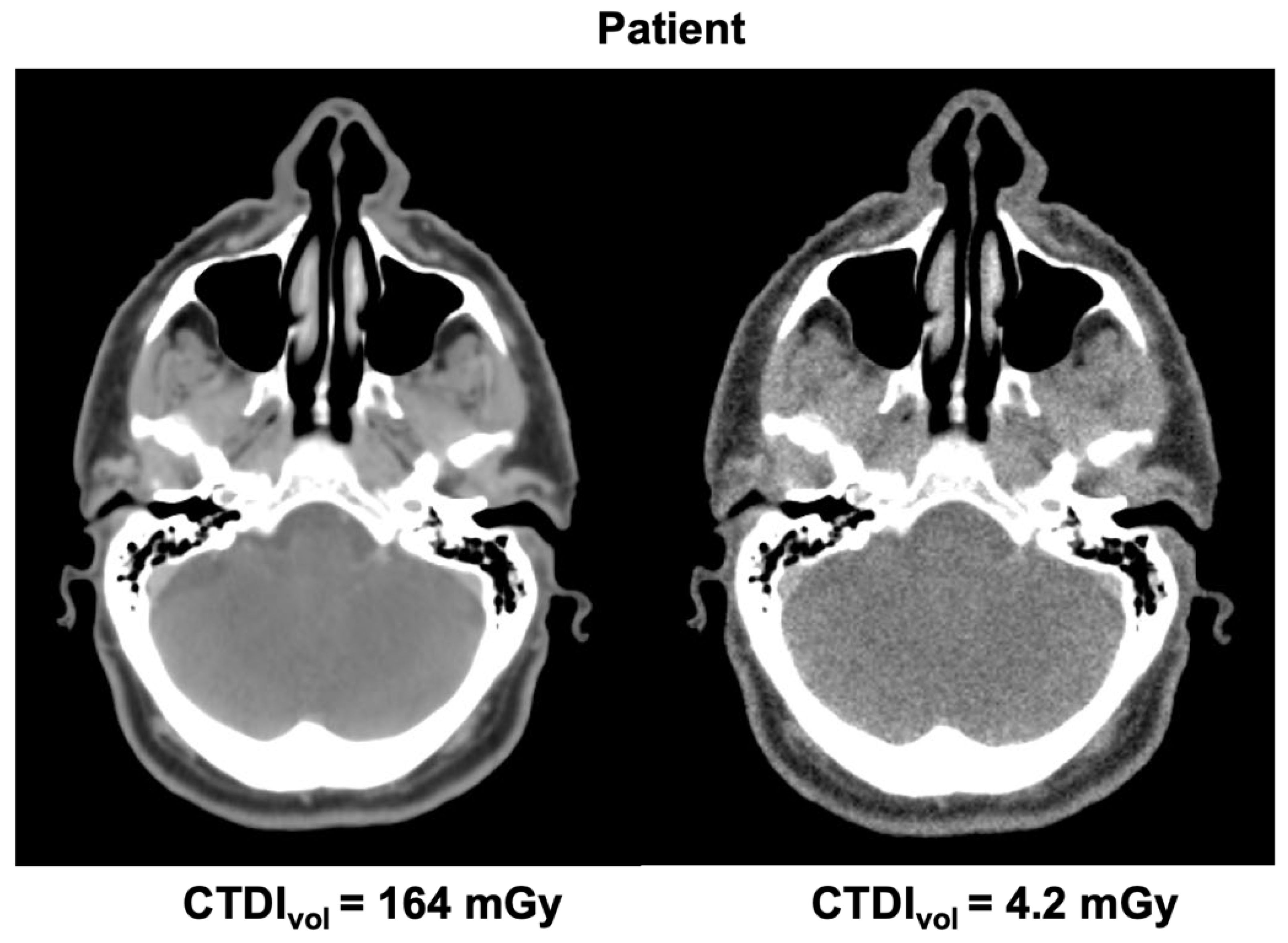 Cancers 14 05155 g004 Cancers 14 05155 g004