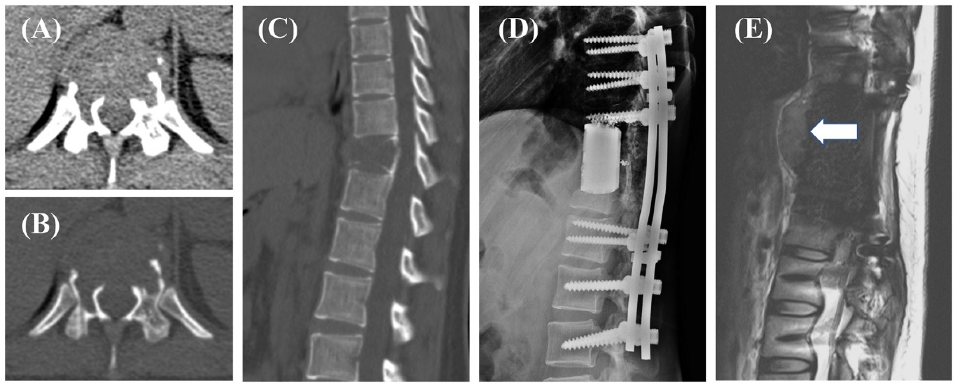 Cancers 14 05201 g002 Cancers 14 05201 g002
