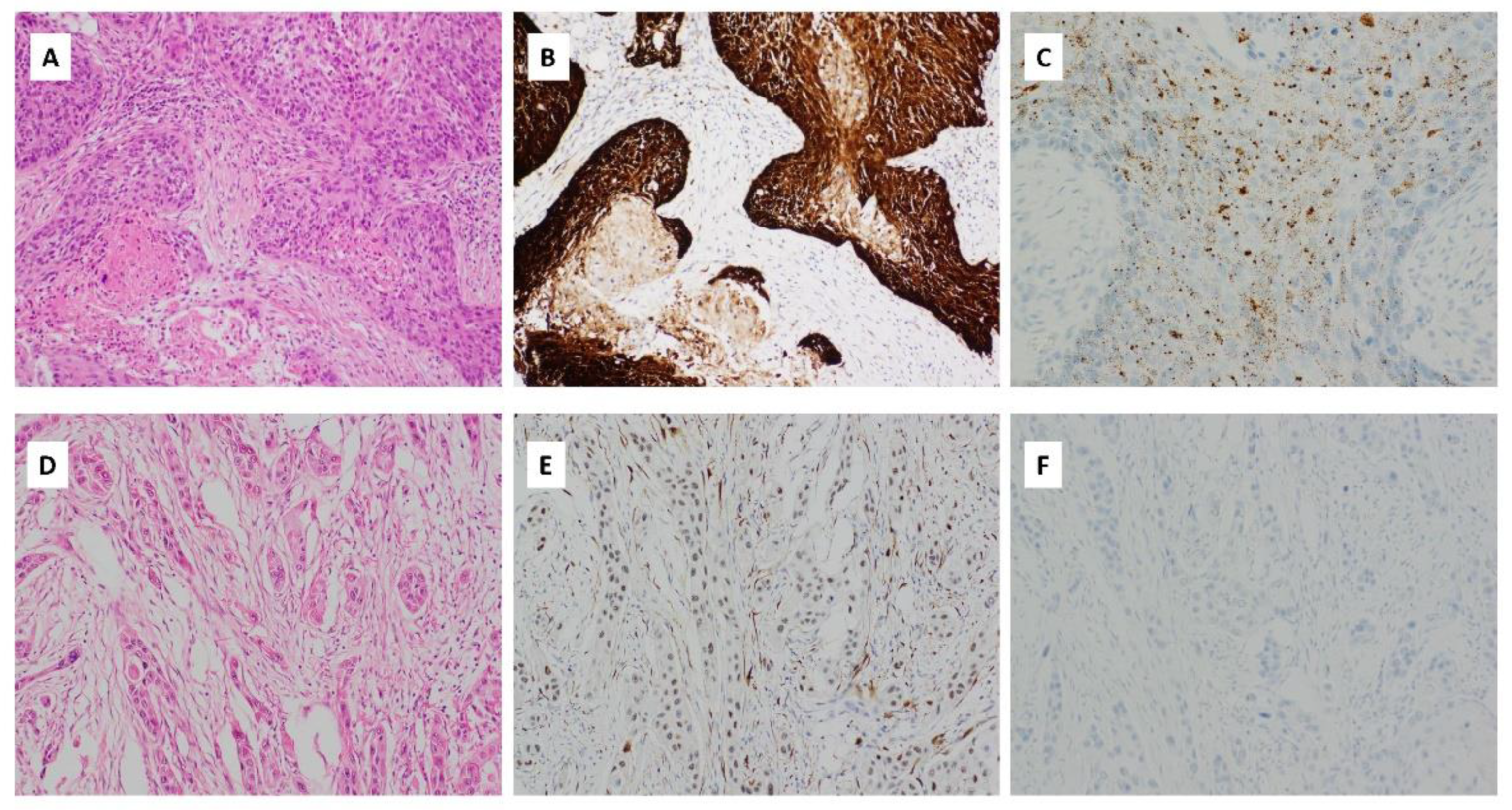 Cancers 14 05213 g005