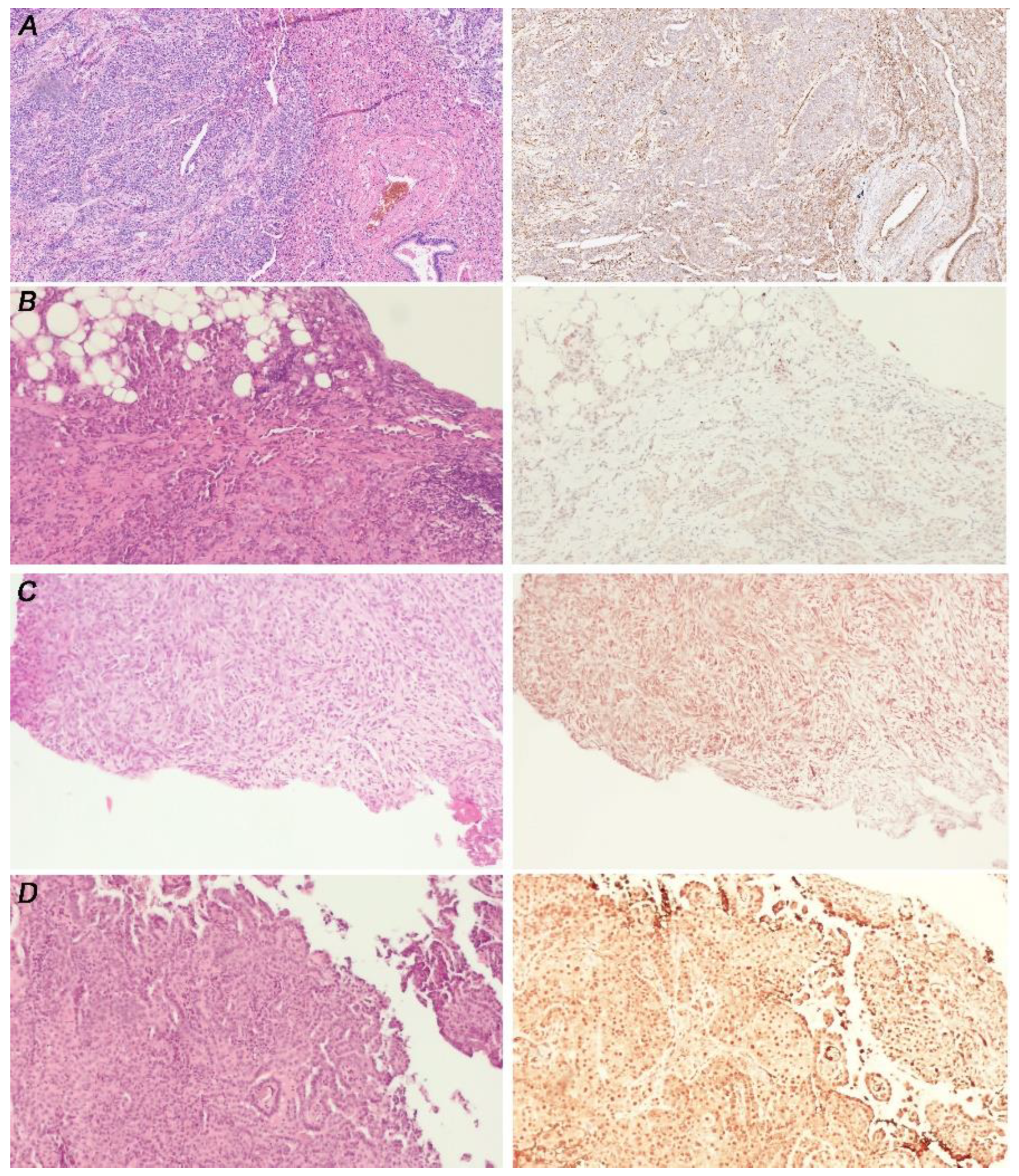 Cancers 14 05216 g005