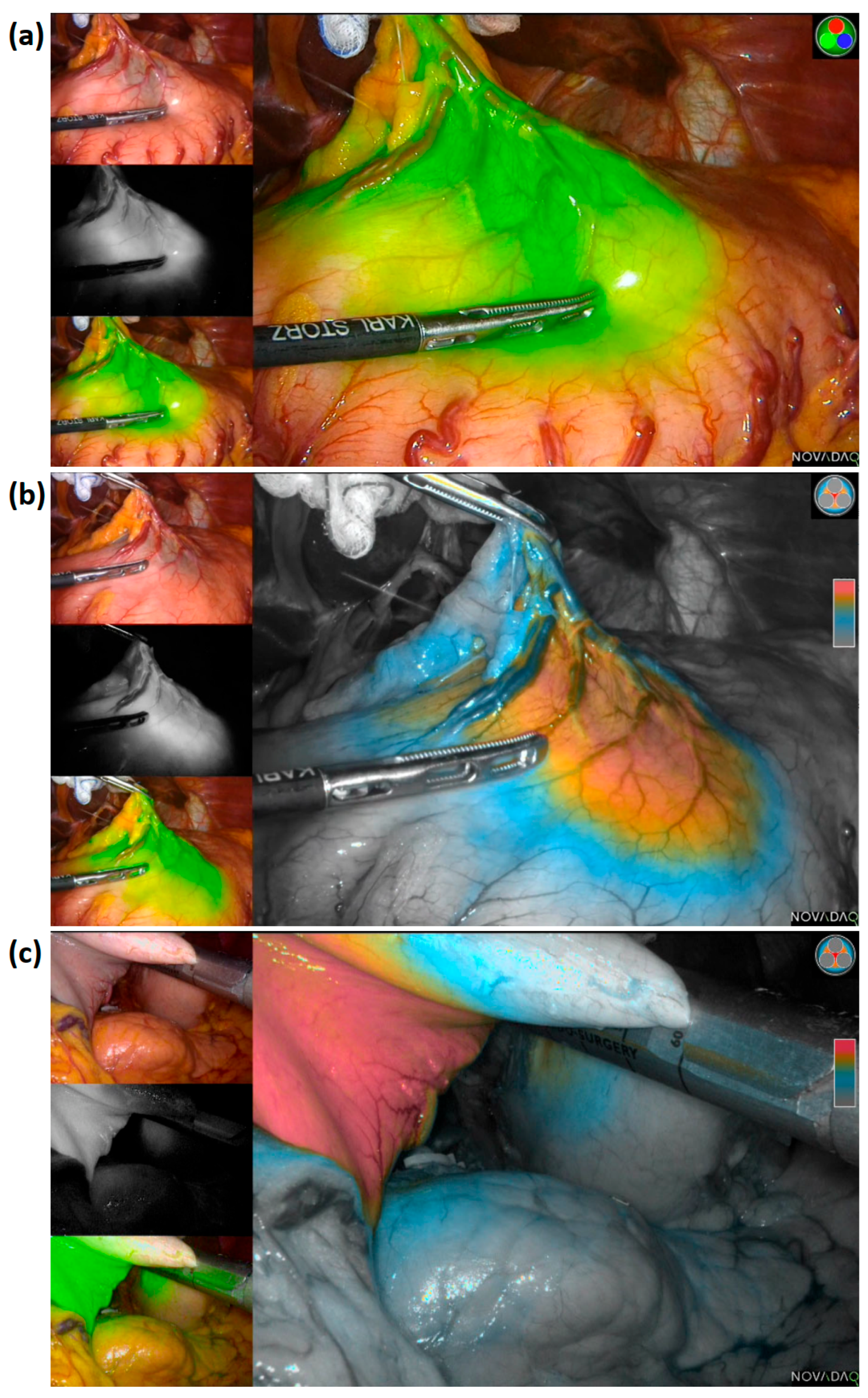 Cancers 14 05223 g002